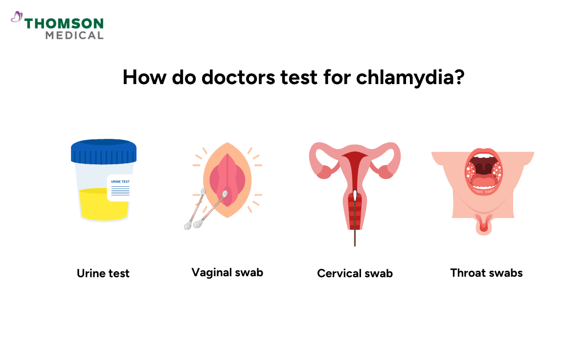 Illustration of how doctors test for chlamydia