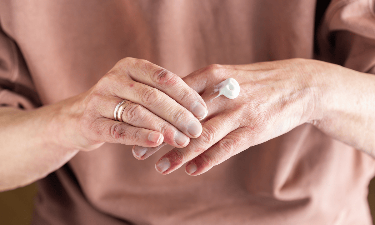 image of older women using lotion medication