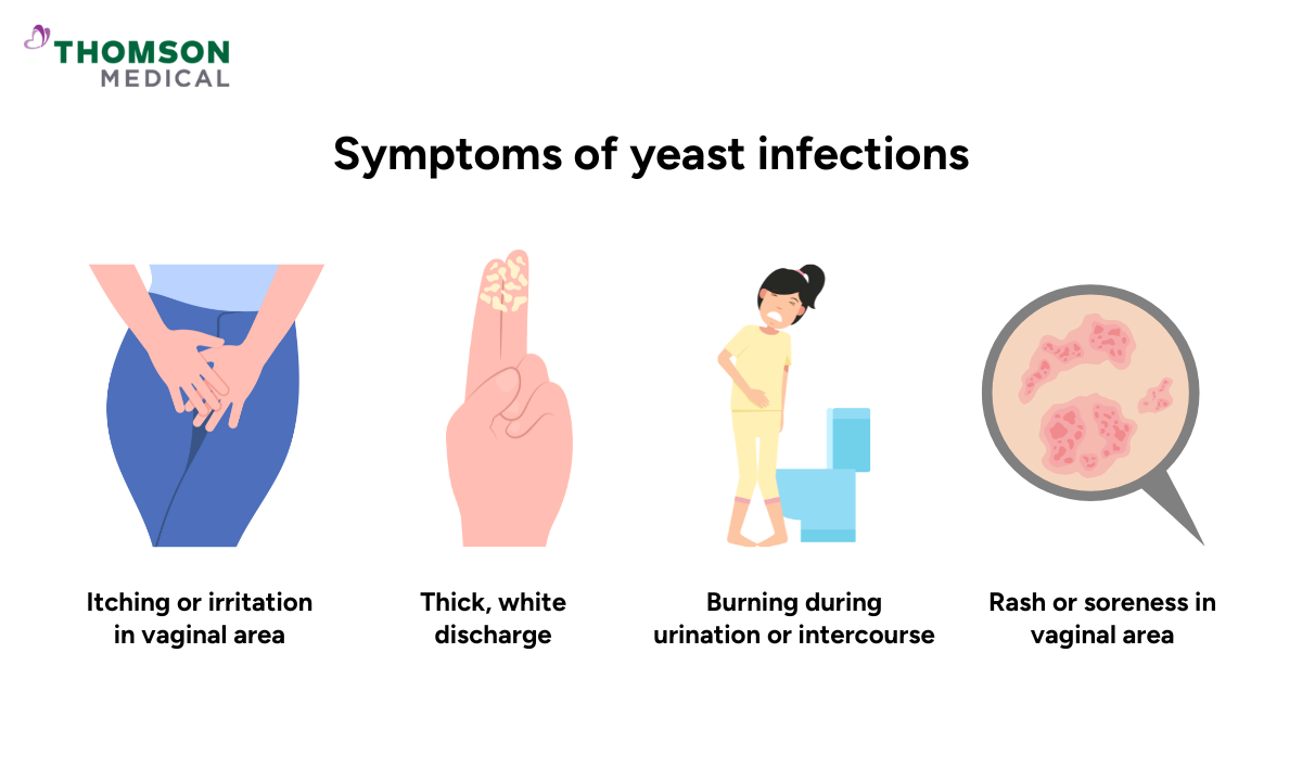 illustration of symptoms of yeast infections