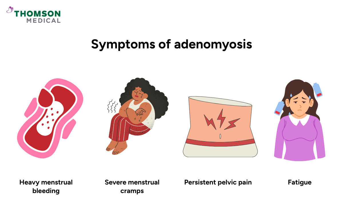 symptoms of adenomyosis
