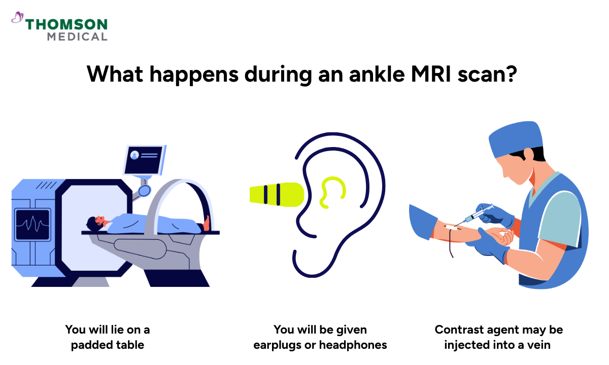 Illustration of what happens during an ankle MRI scan