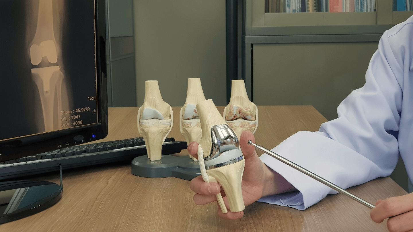 Total_Knee_Replacement_1440x810.png