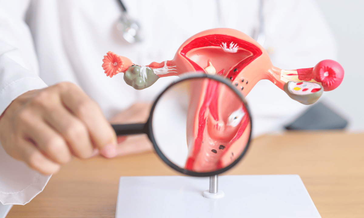 A doctor uses a magnifying glass to examine a detailed anatomical model of the female reproductive system, including the uterus and ovaries.