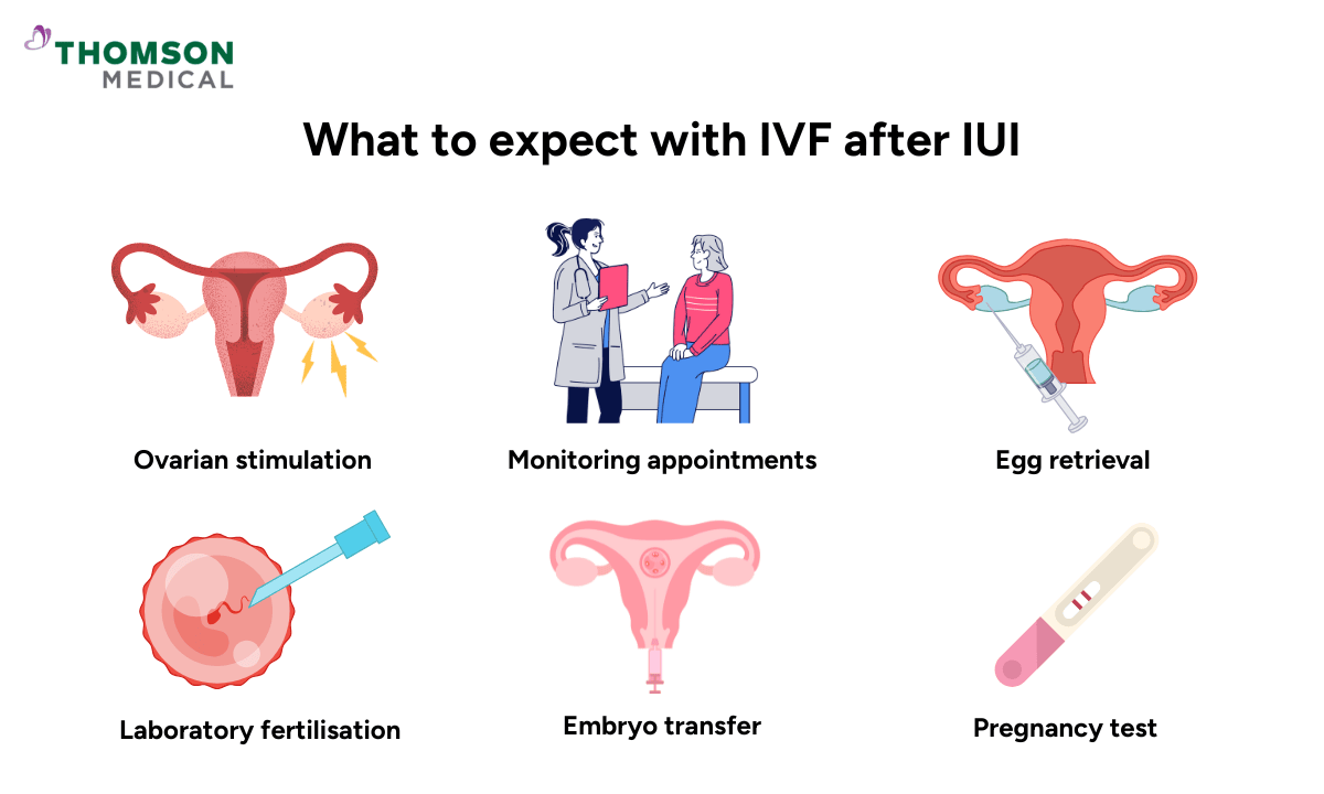 What to expect with IVF after IUI