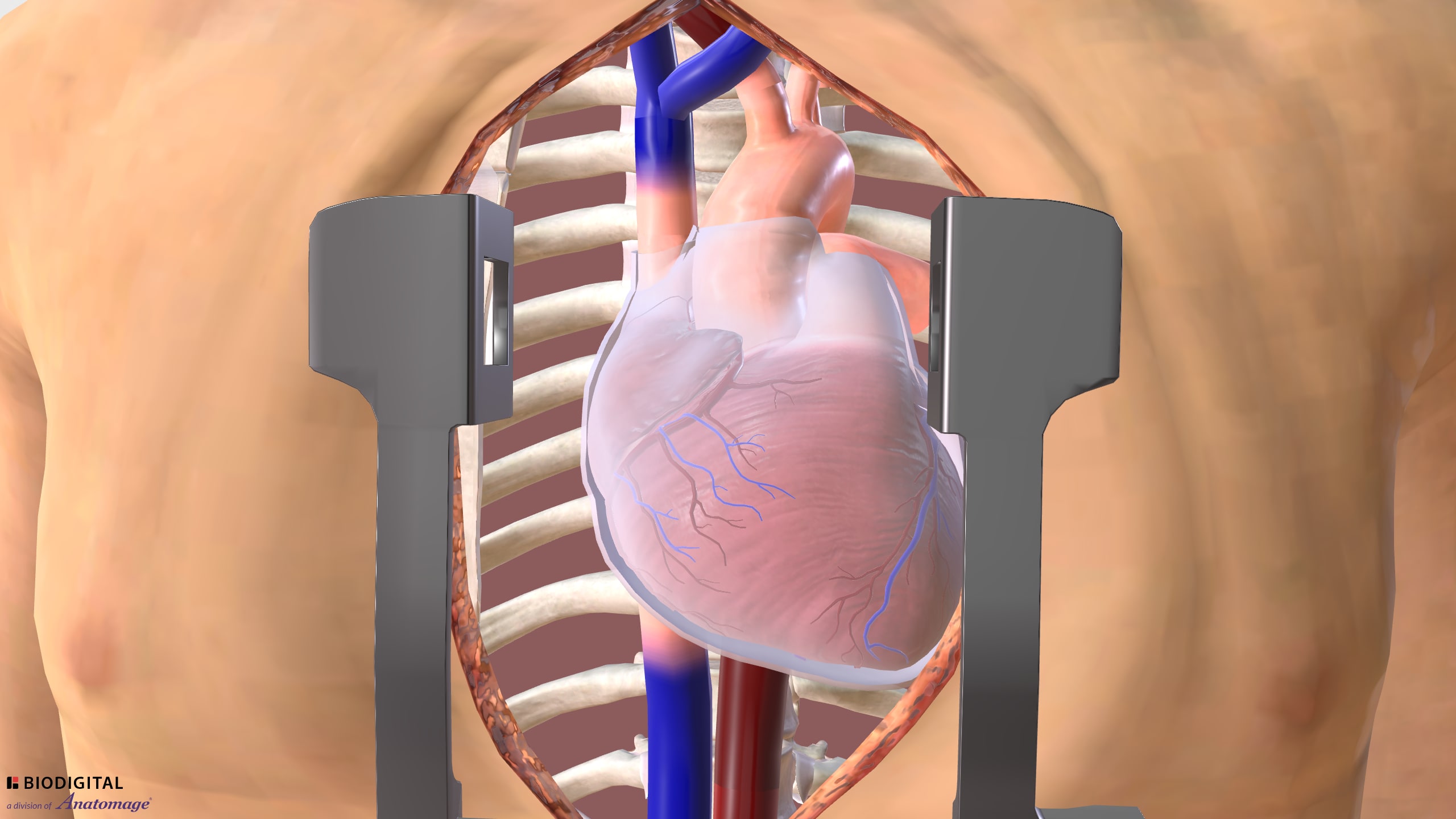 Relevant anatomy for coronary artery bypass graft