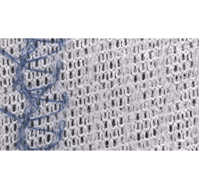 PROCEED™ Surgical Mesh | J&J MedTech US