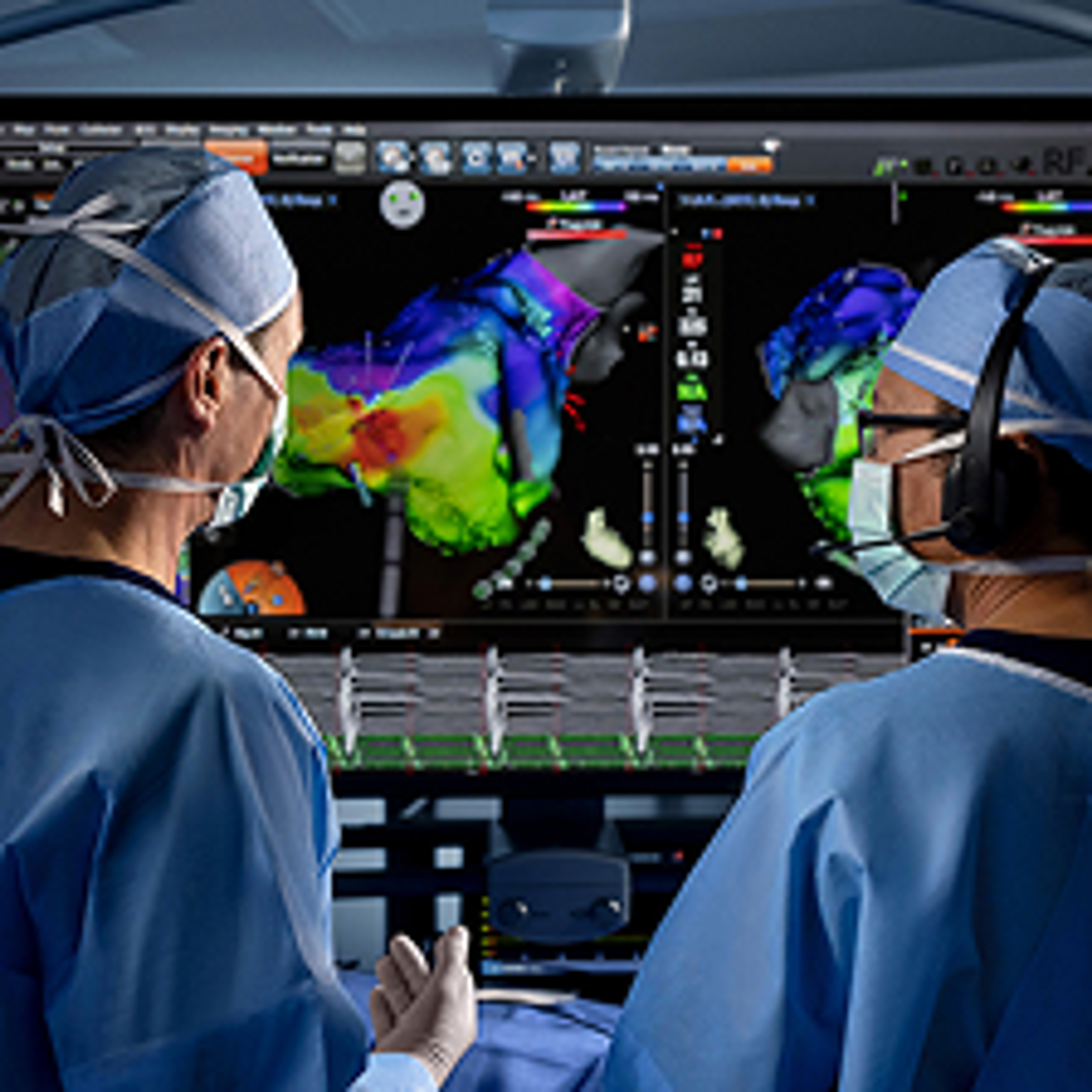THERMOCOOL SMARTTOUCH™ SF Catheter | J&J MedTech US