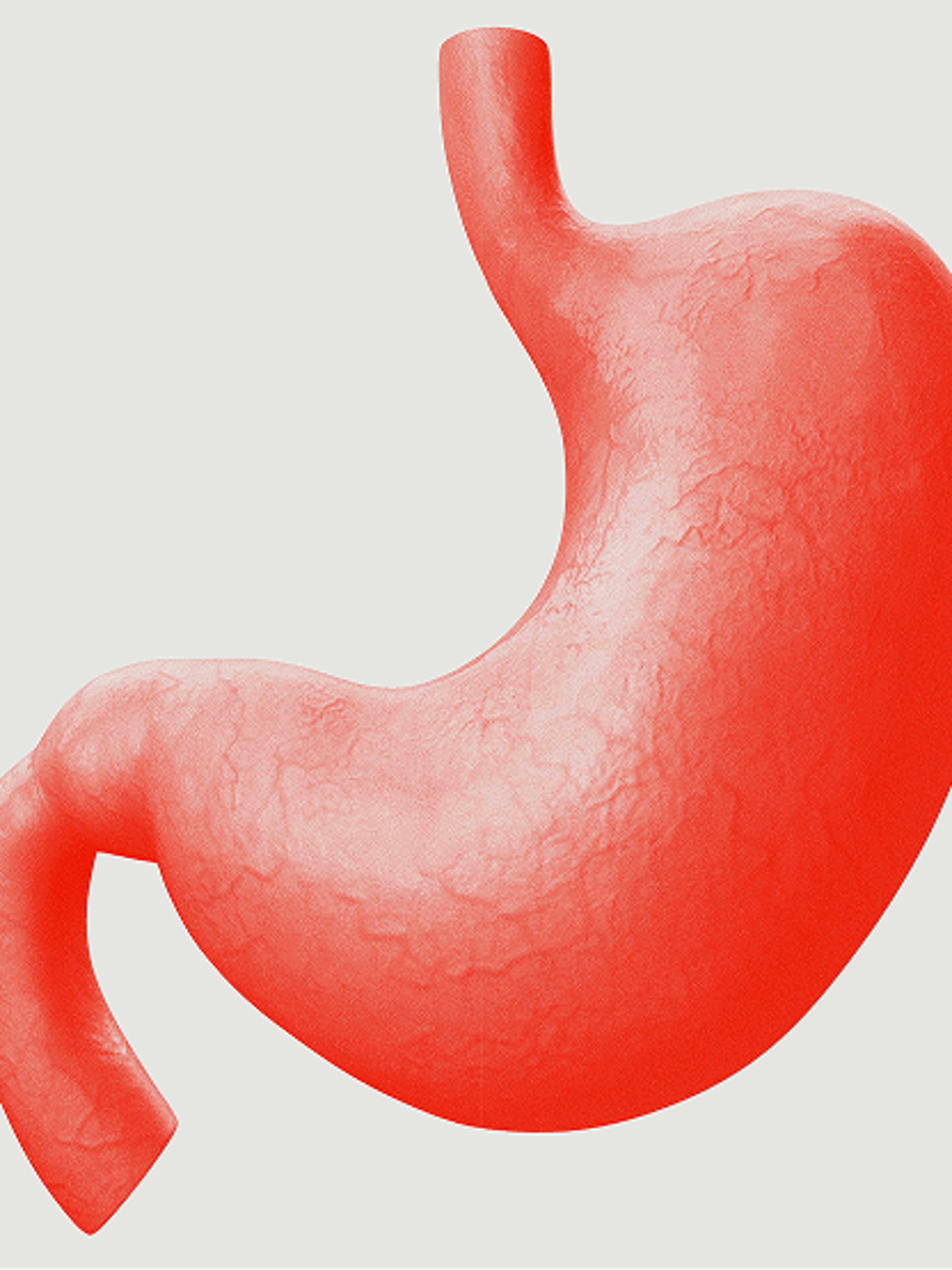 Bariatric