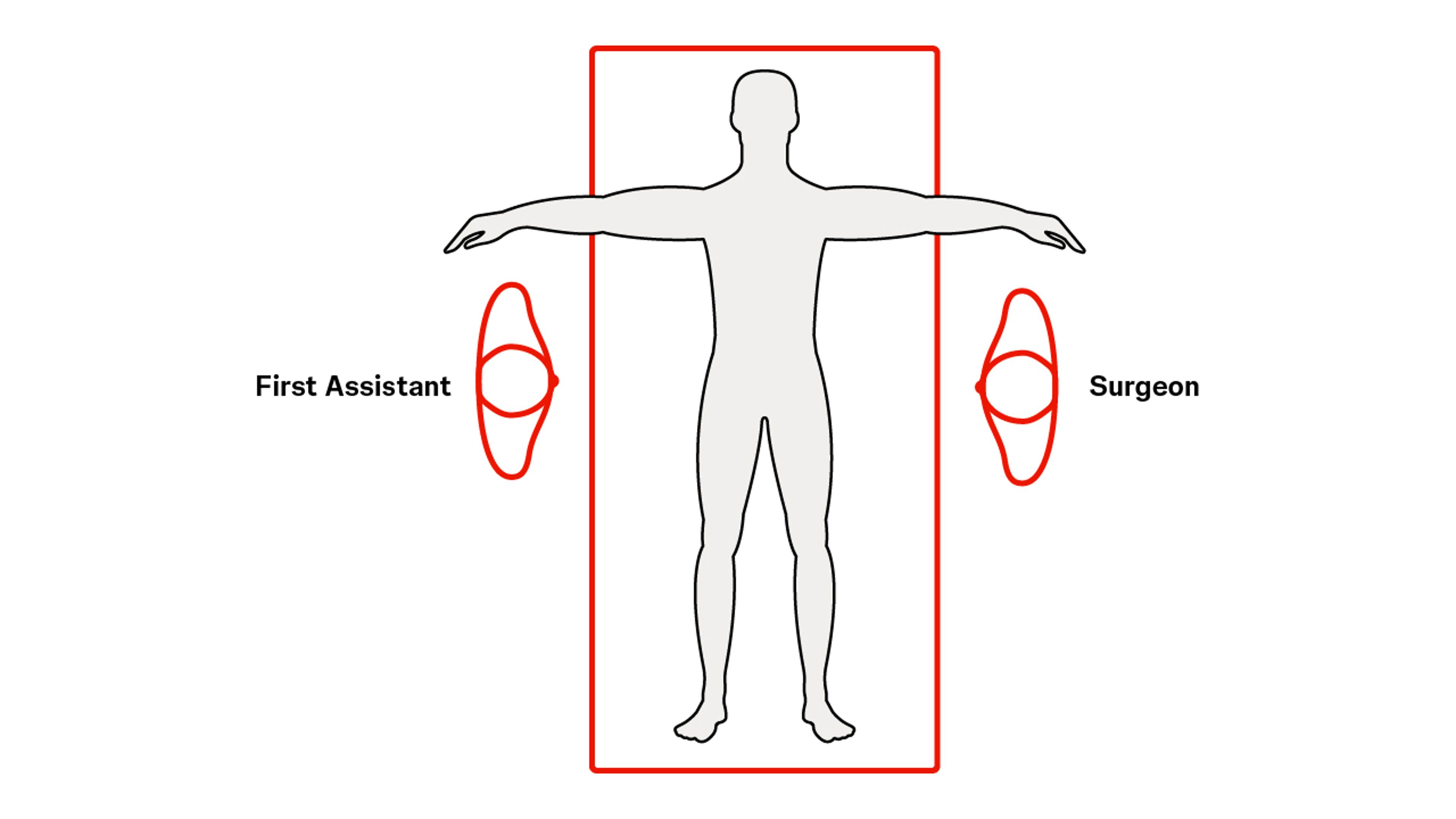 Right Hepatectomy prep & postion 1