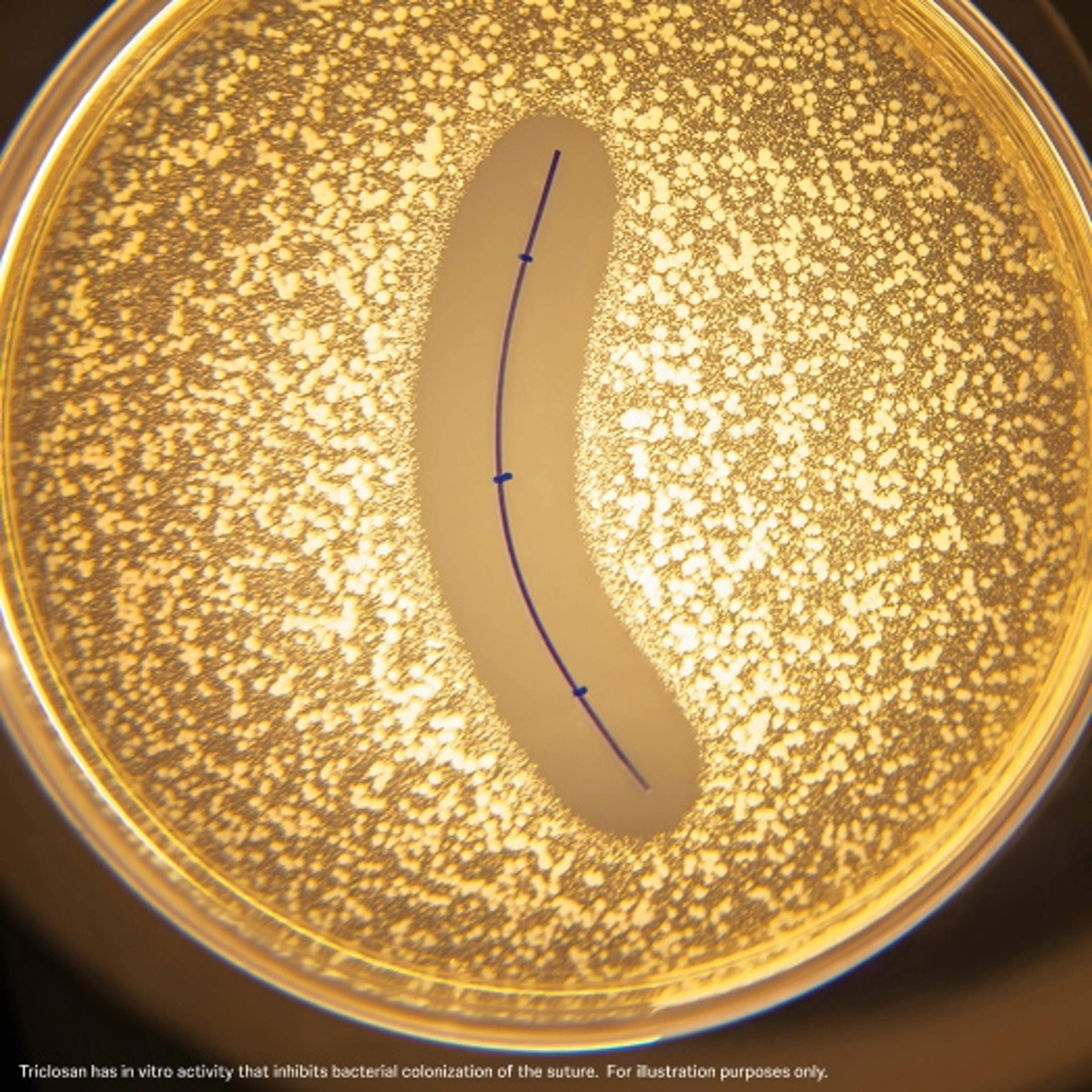 Triclosan has in vitro activity that inhibits bacterial colonization of the suture. For illustration purposes only.