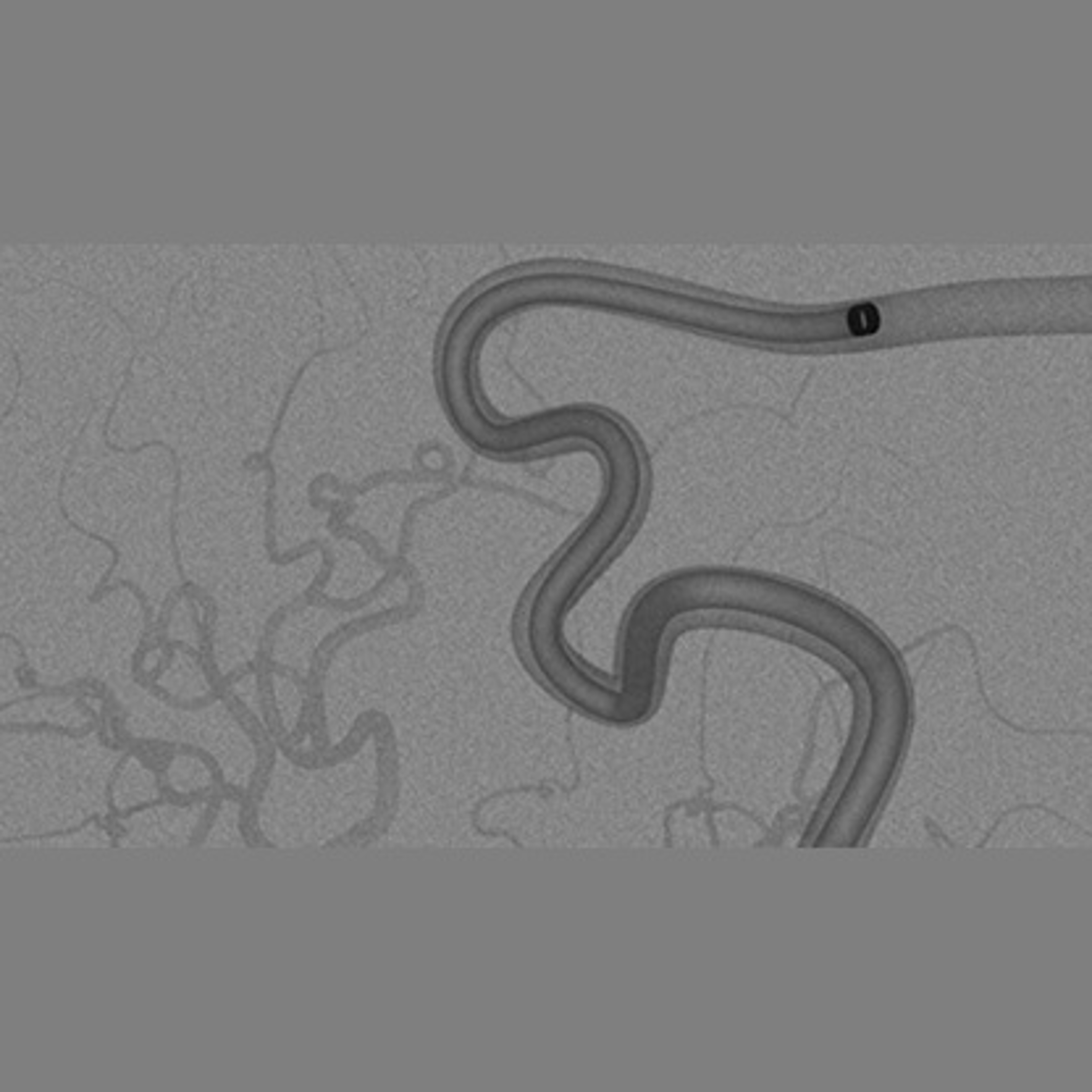 CEREGLIDE™ 92 Catheter System with TruCourse™