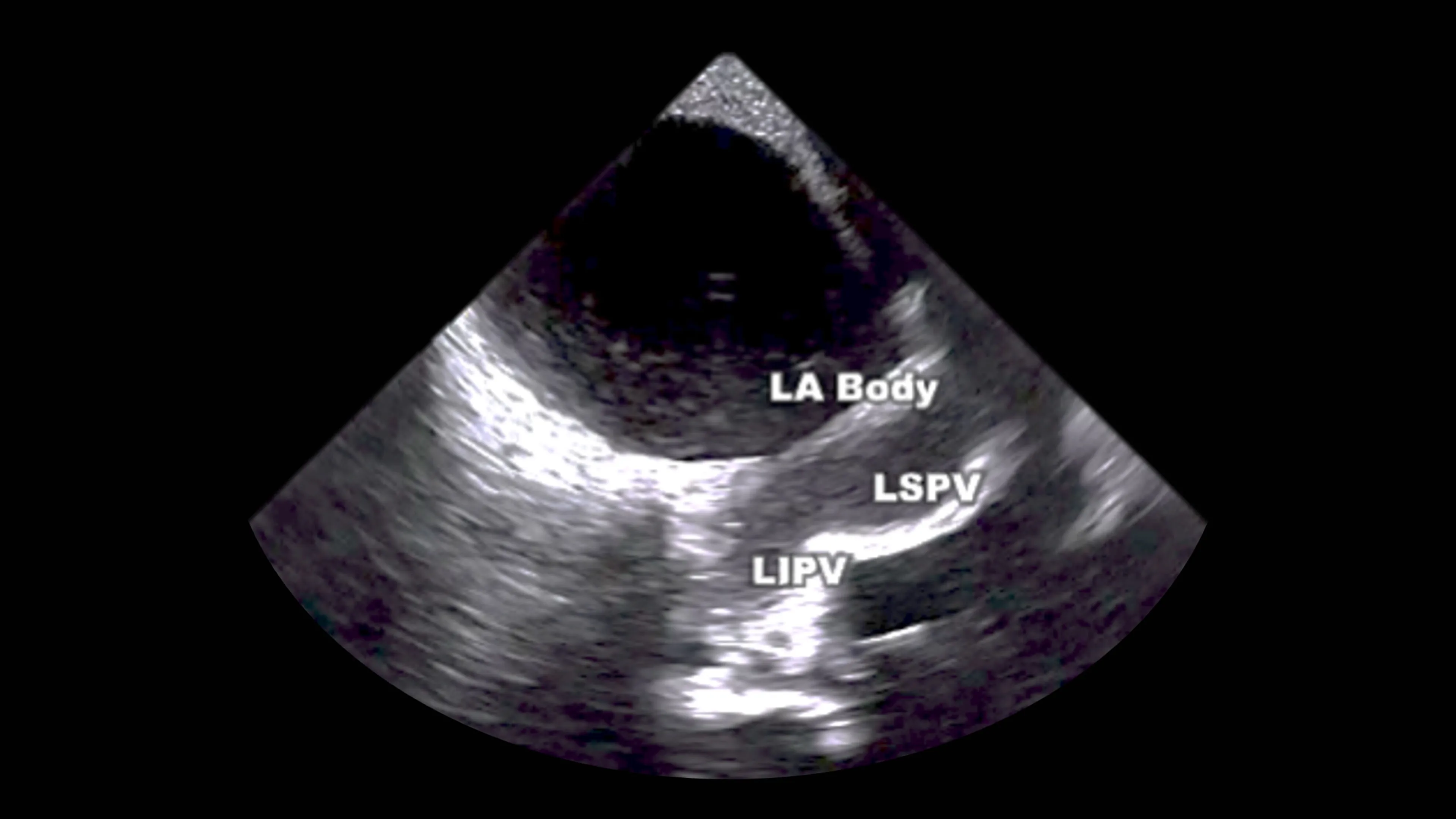 Auto labeling in ultrasound