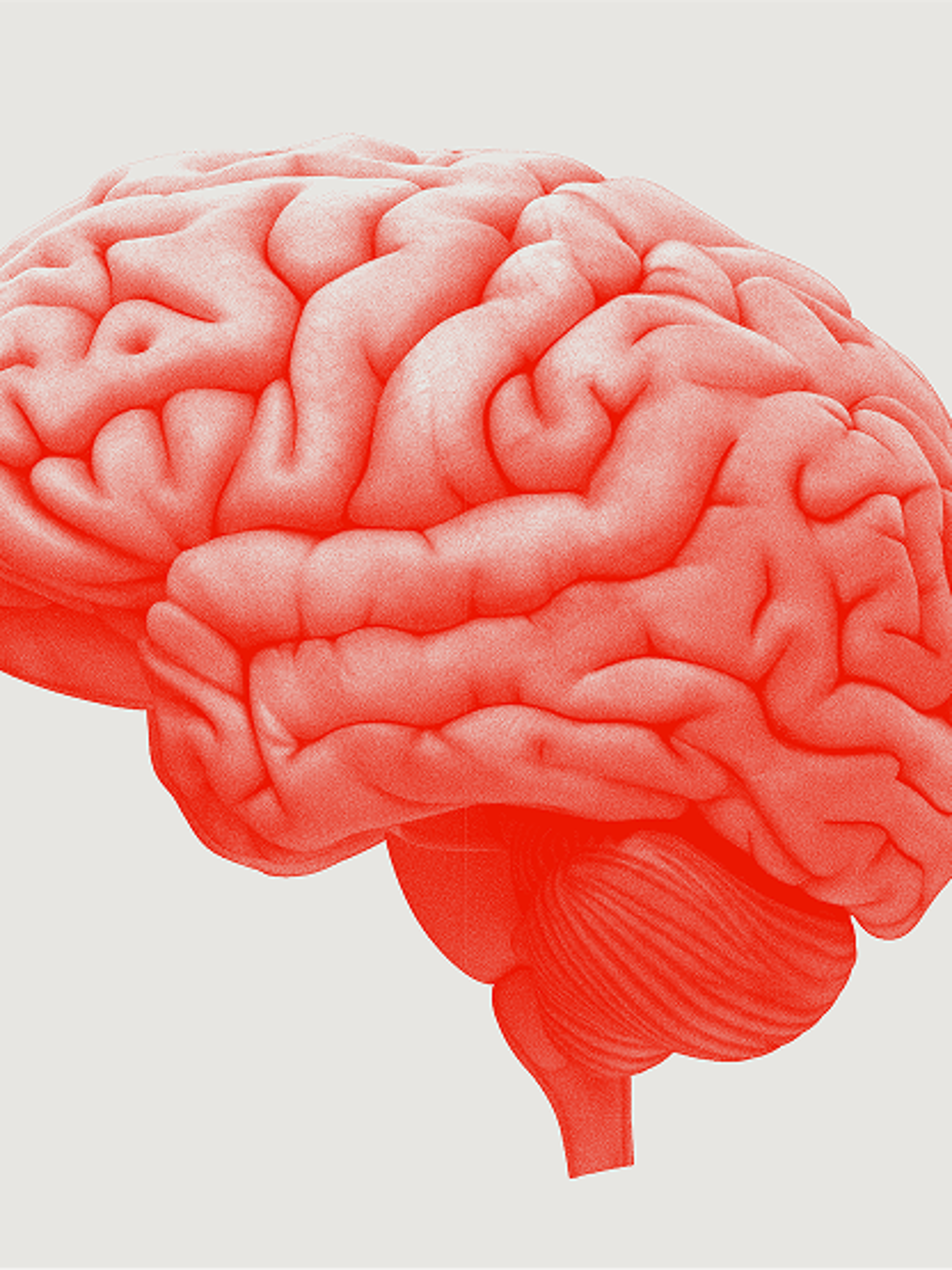 Neurointerventional​