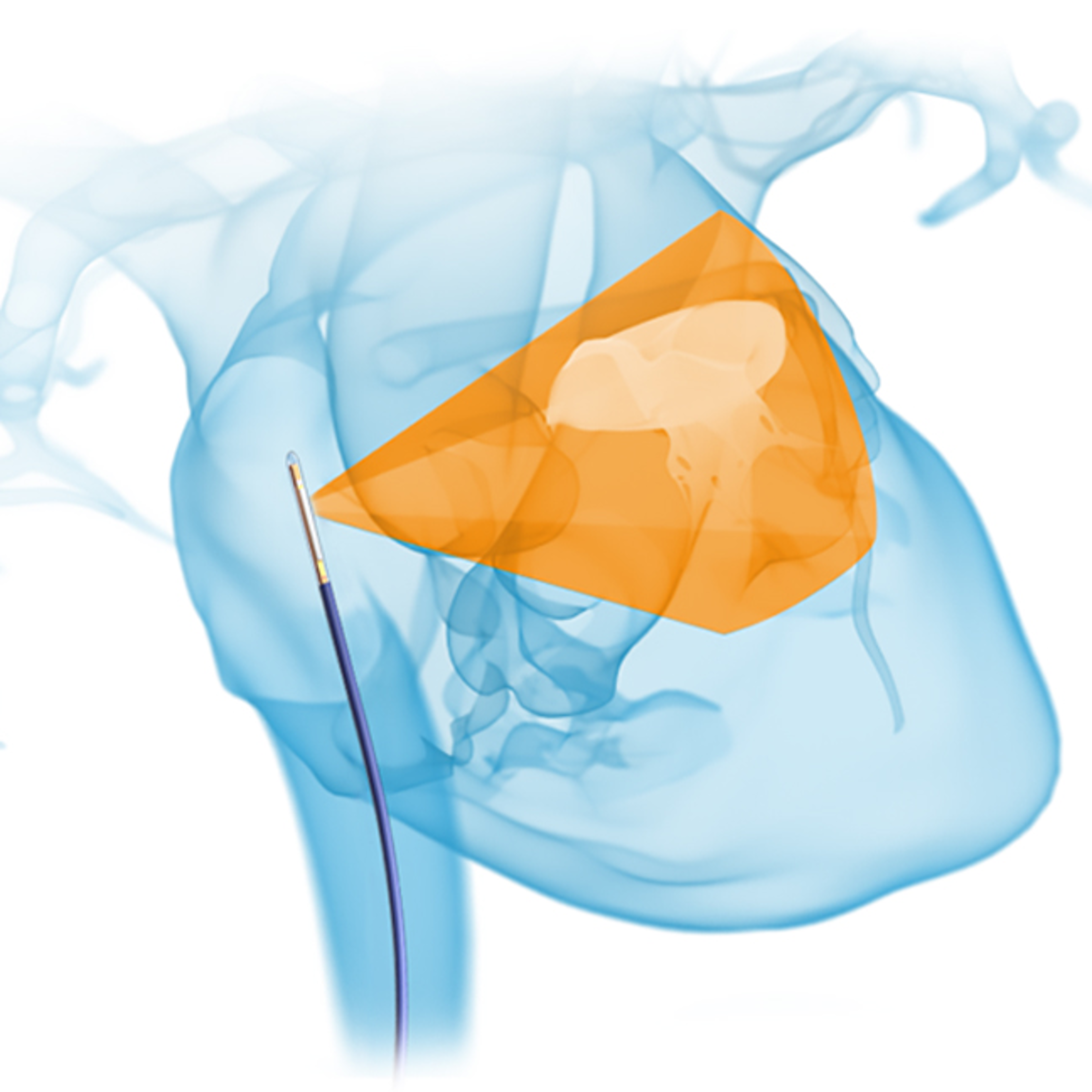Multiplanar imaging