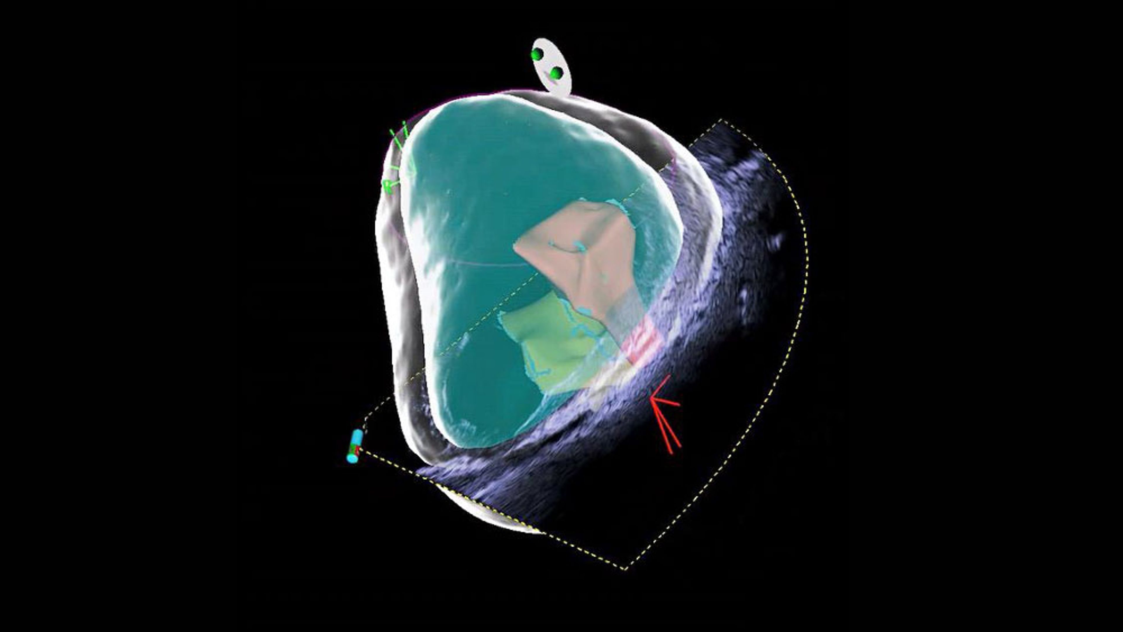 Audo 3D reconstruction offers deeper insights.
