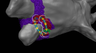 VARIPULSE™ Platform | J&J MedTech US