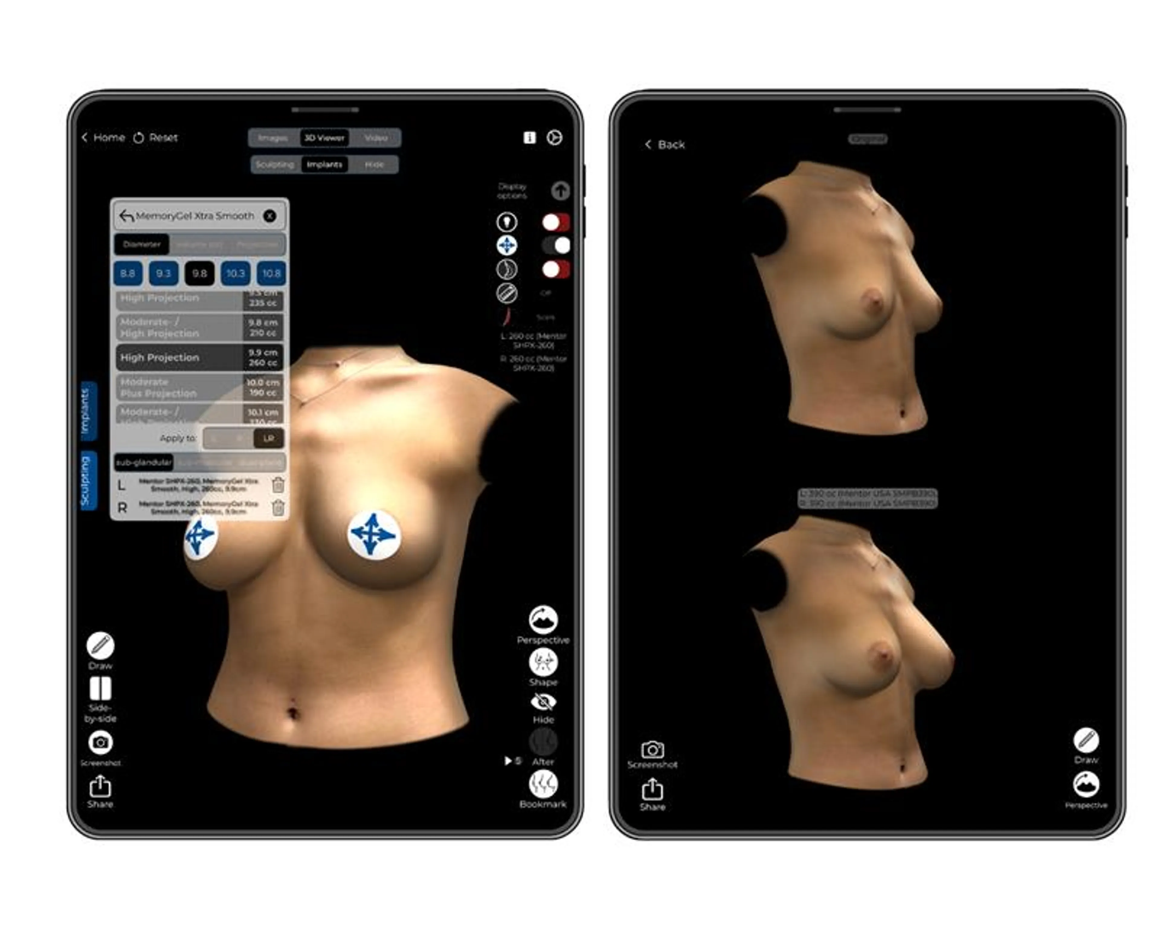 Arbrea Breast Simulator Surgeon App for Mentor
