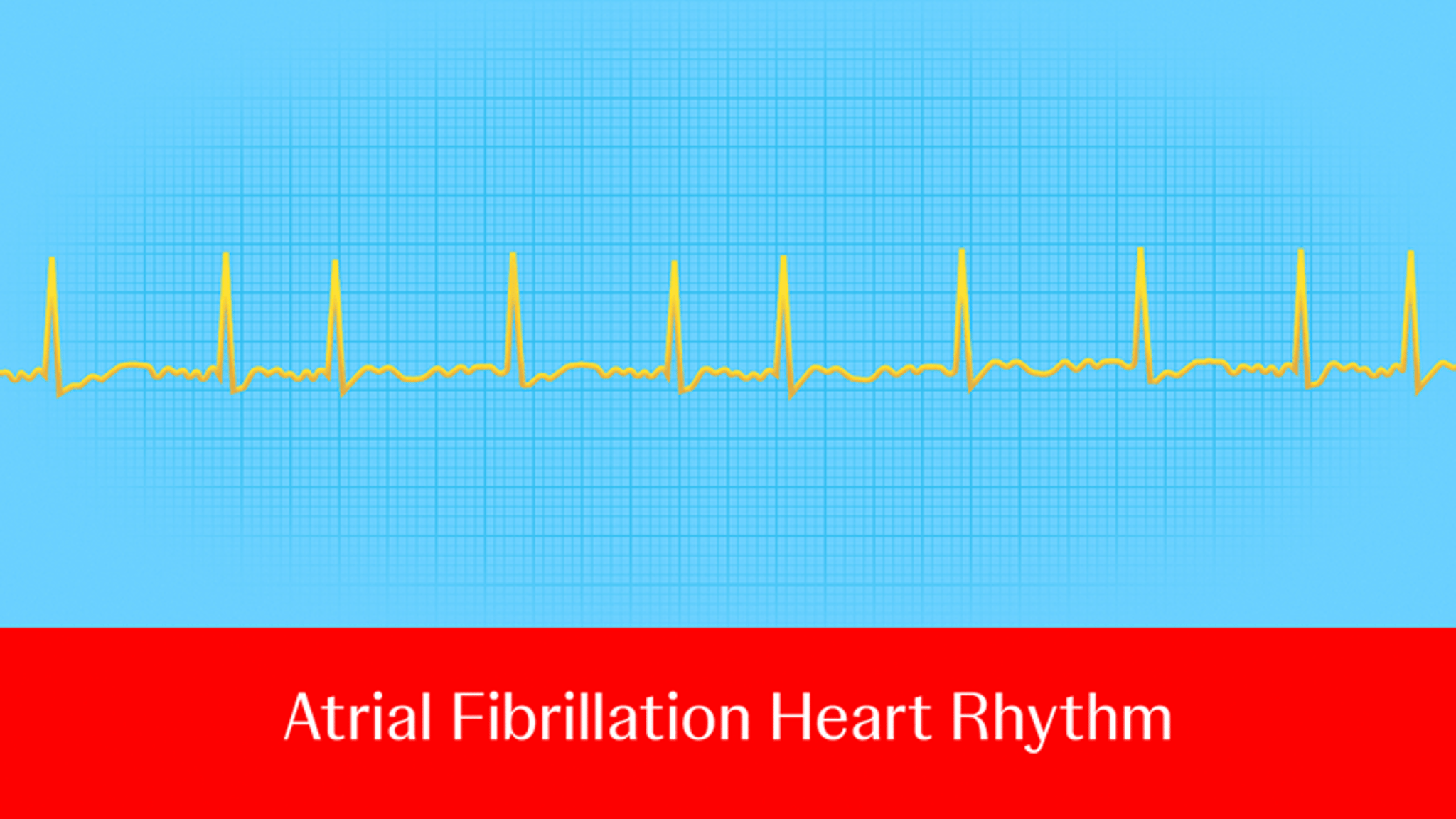Ask an electrophysiologist: What roles do PFA and RFA play in the ...