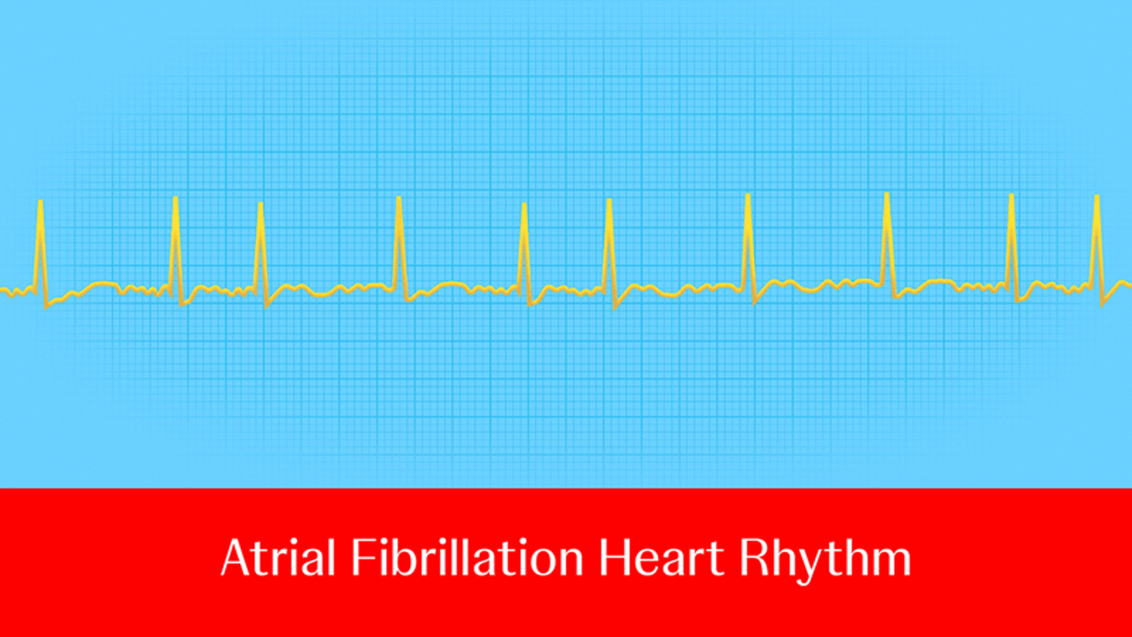 Ask an electrophysiologist: What roles do PFA and RFA play in the treatment of AFib?