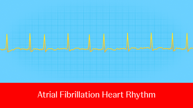 Ask an electrophysiologist: What roles do PFA and RFA play in the ...
