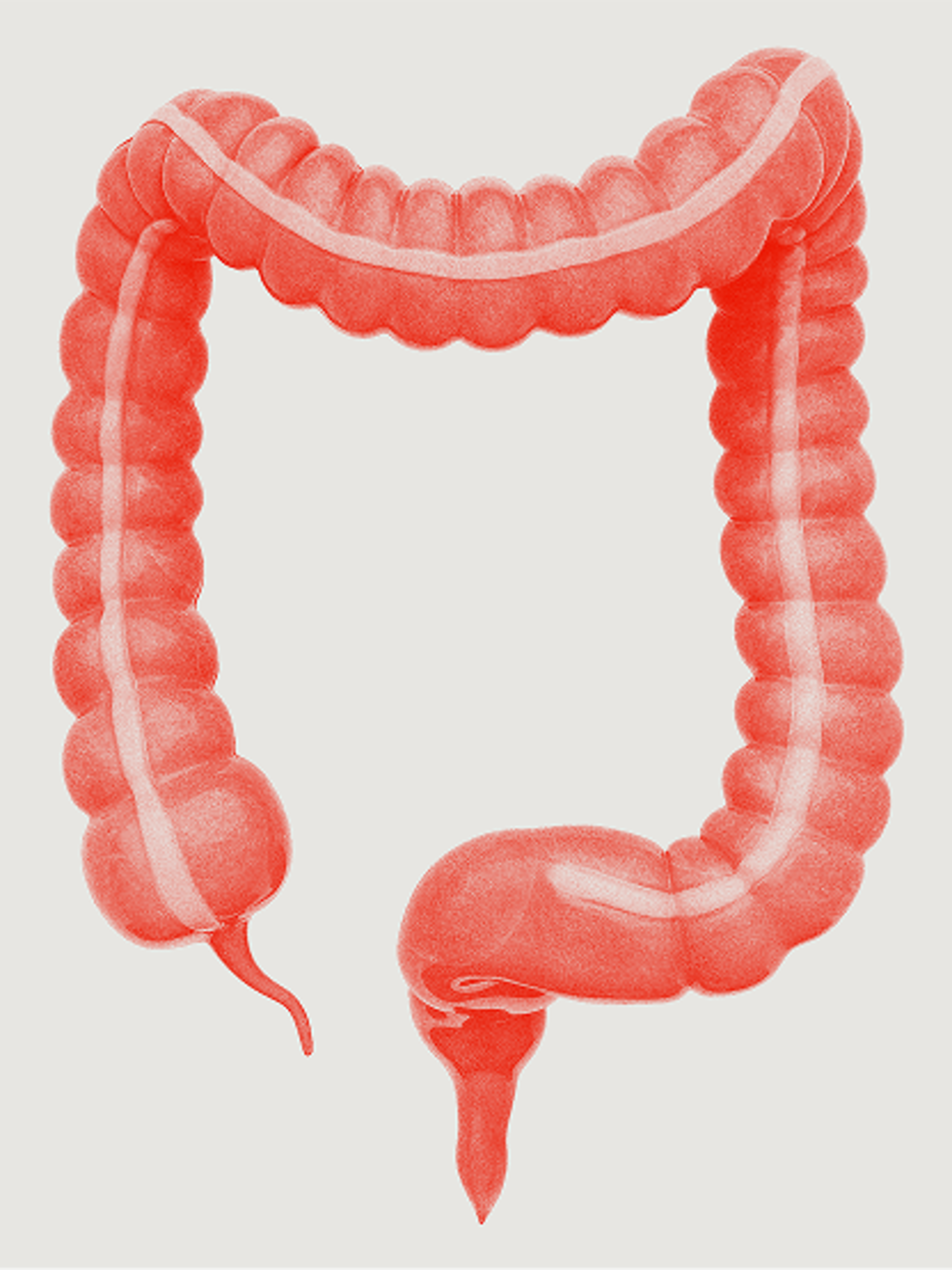 An image of a human colon