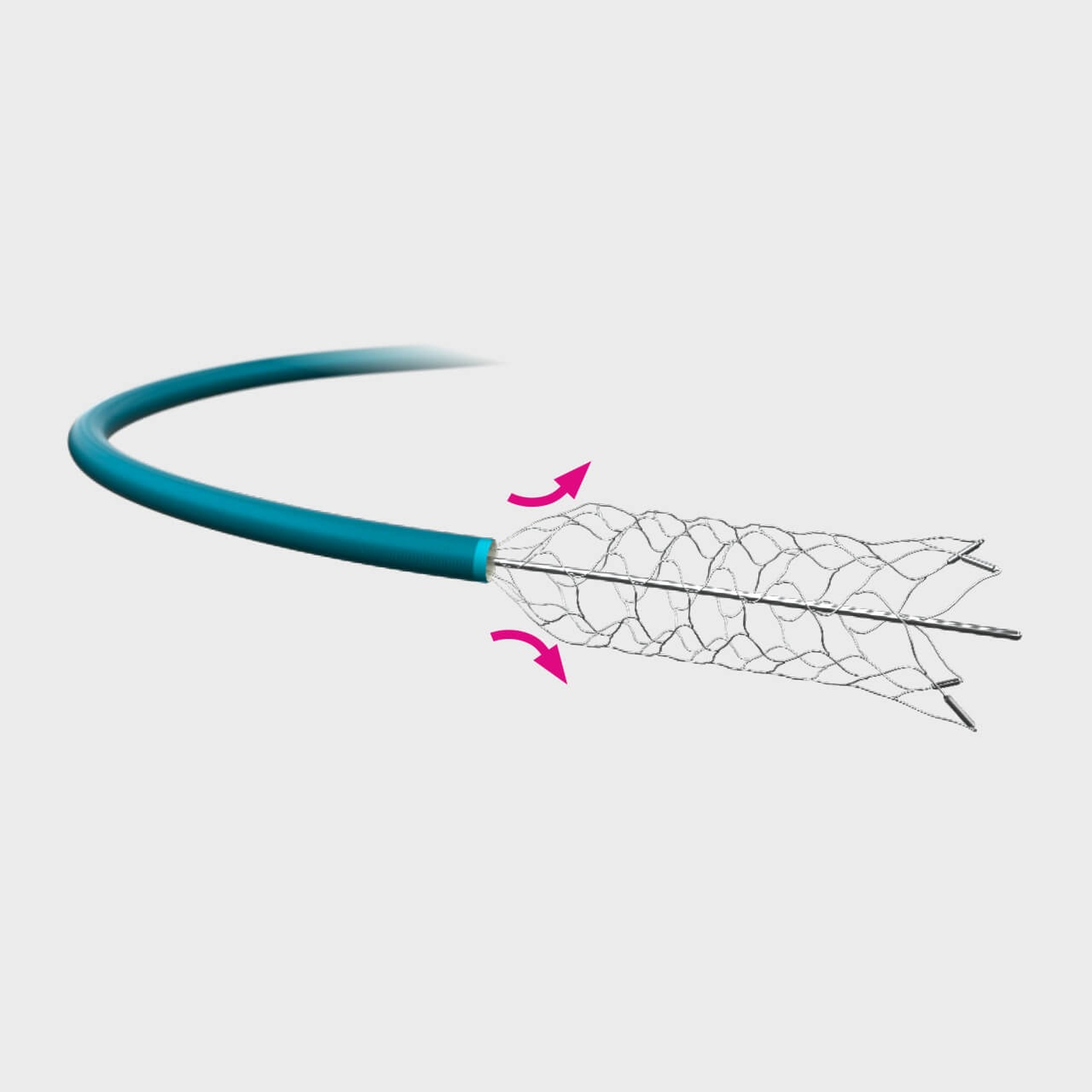 ENTERPRISE™2 Vascular Reconstruction Device
