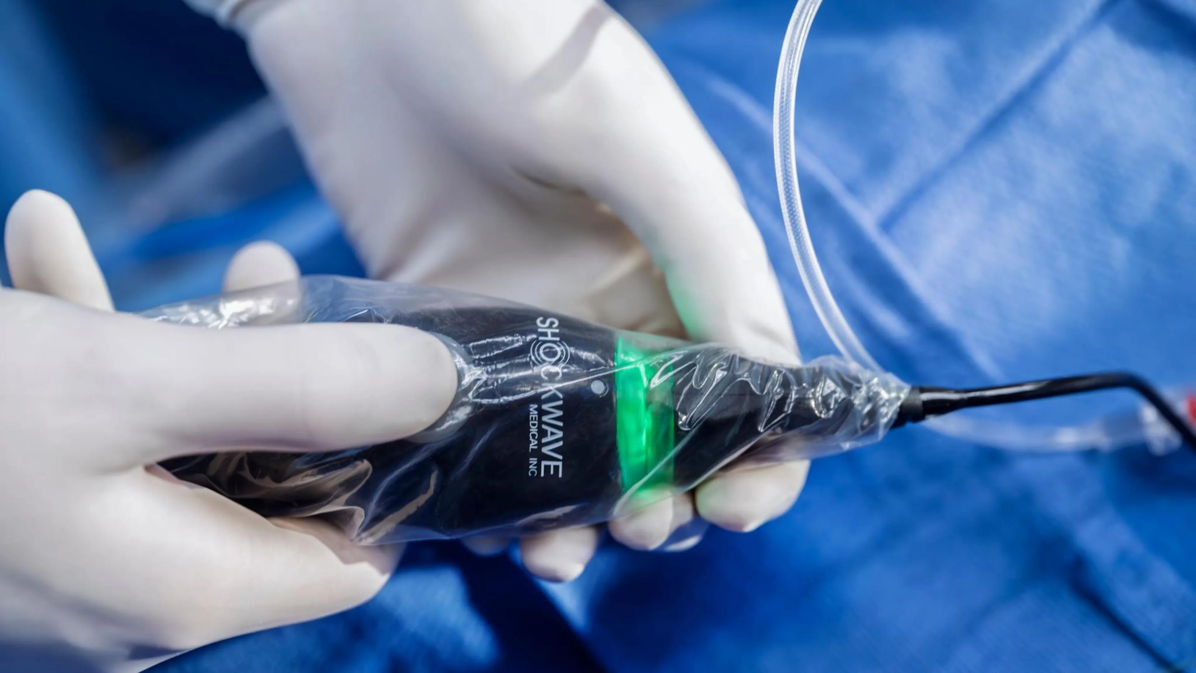 The Shockwave™ C2 Aero Fly Coronary IVL Catheter delivers pulses at 2 Hz, cutting IVL treatment time in half.