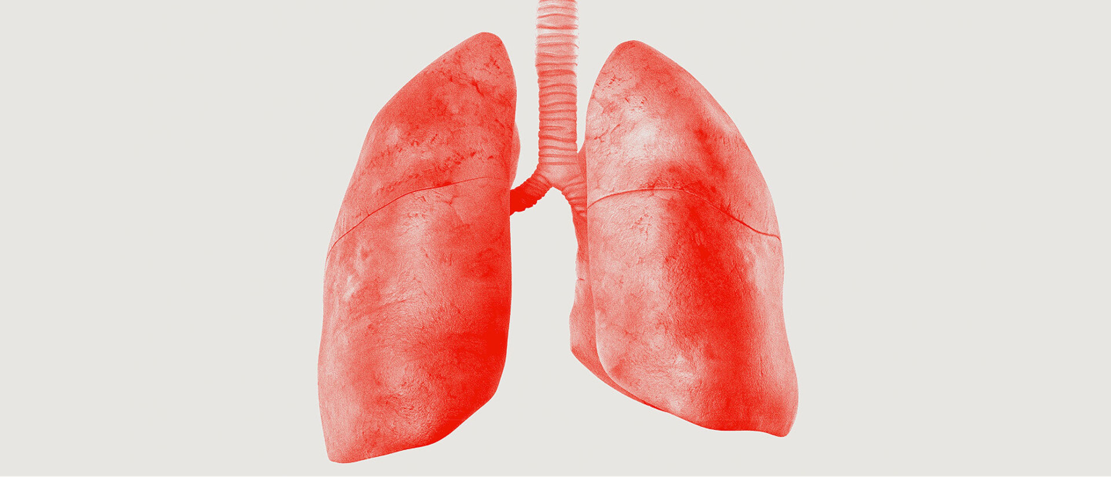 Interventional pulmonology