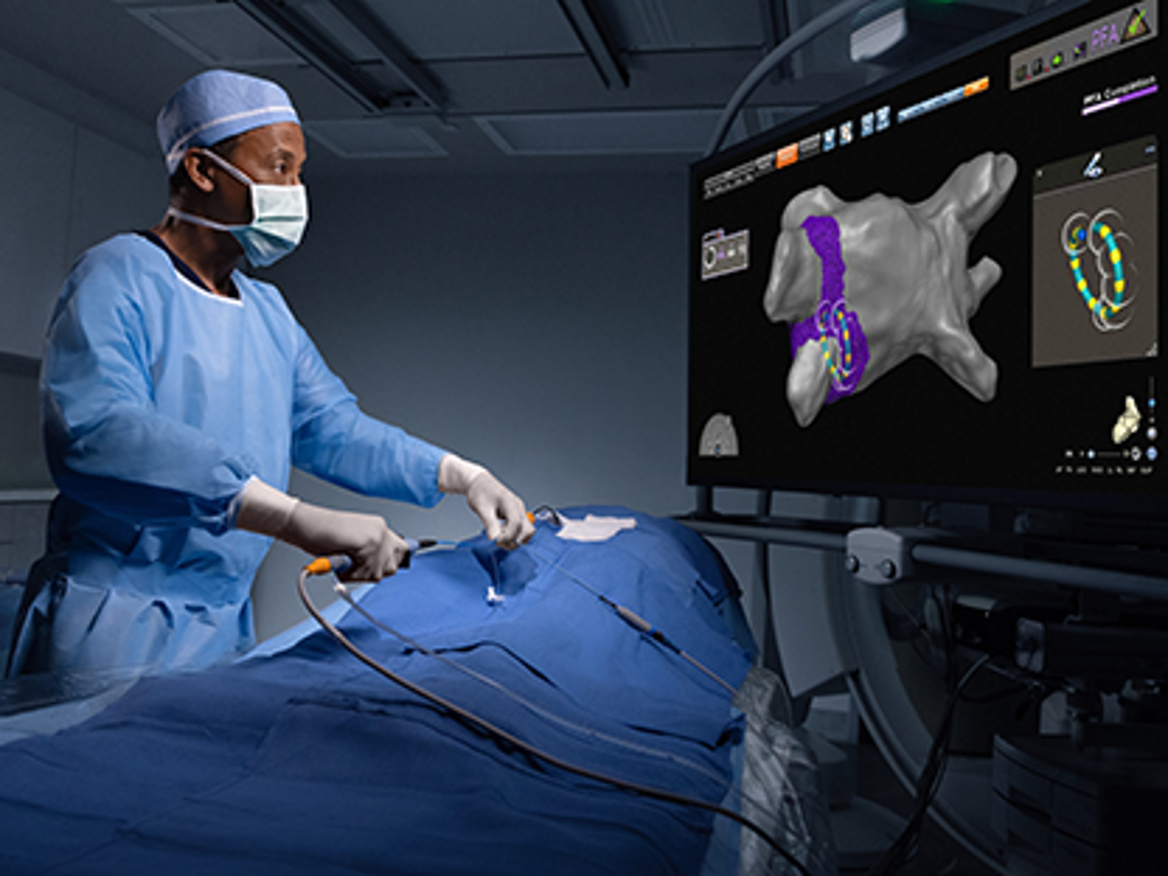 Pulsed field ablation (PFA)