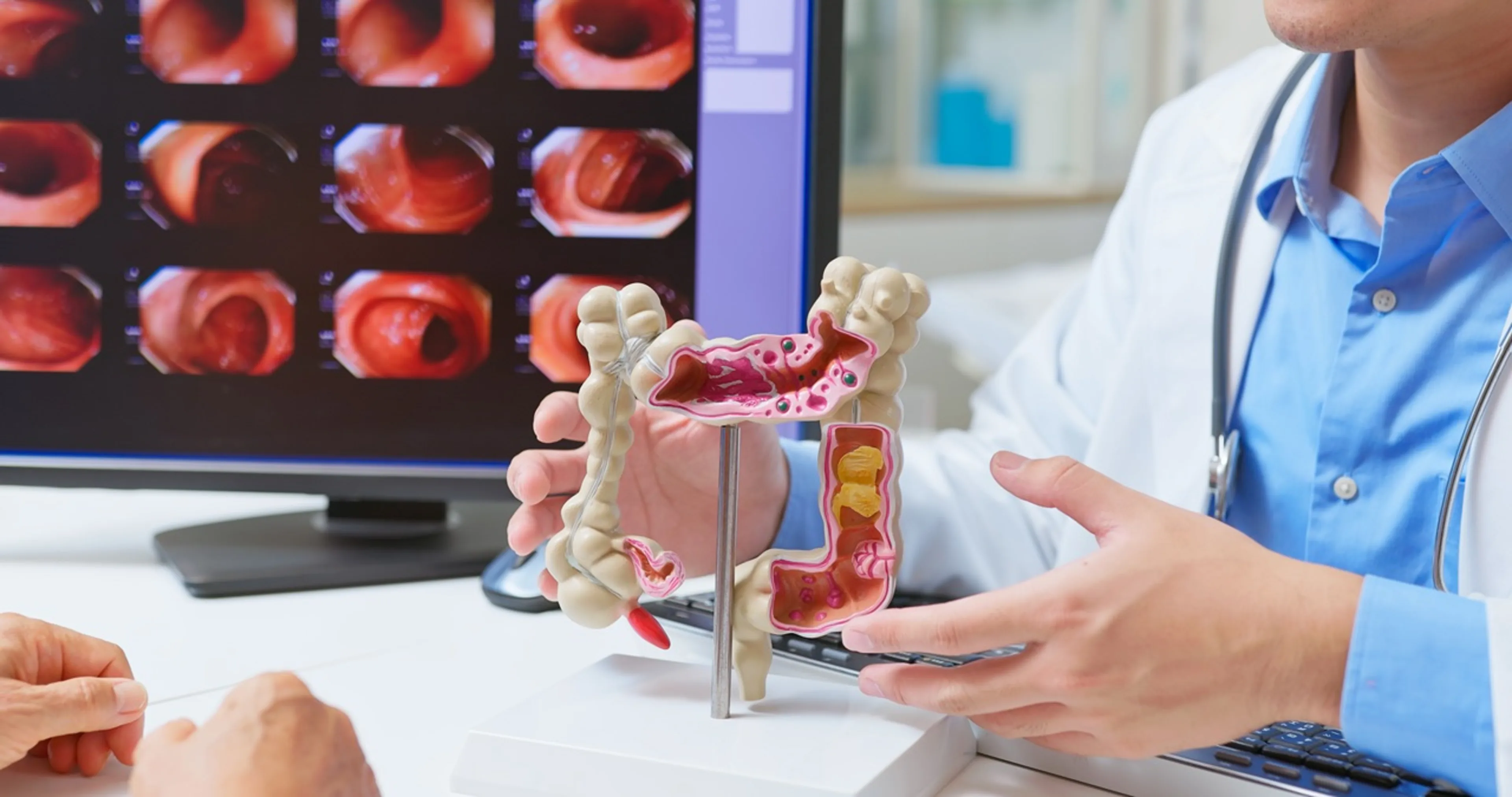 A doctor holding an anatomical model of the colon