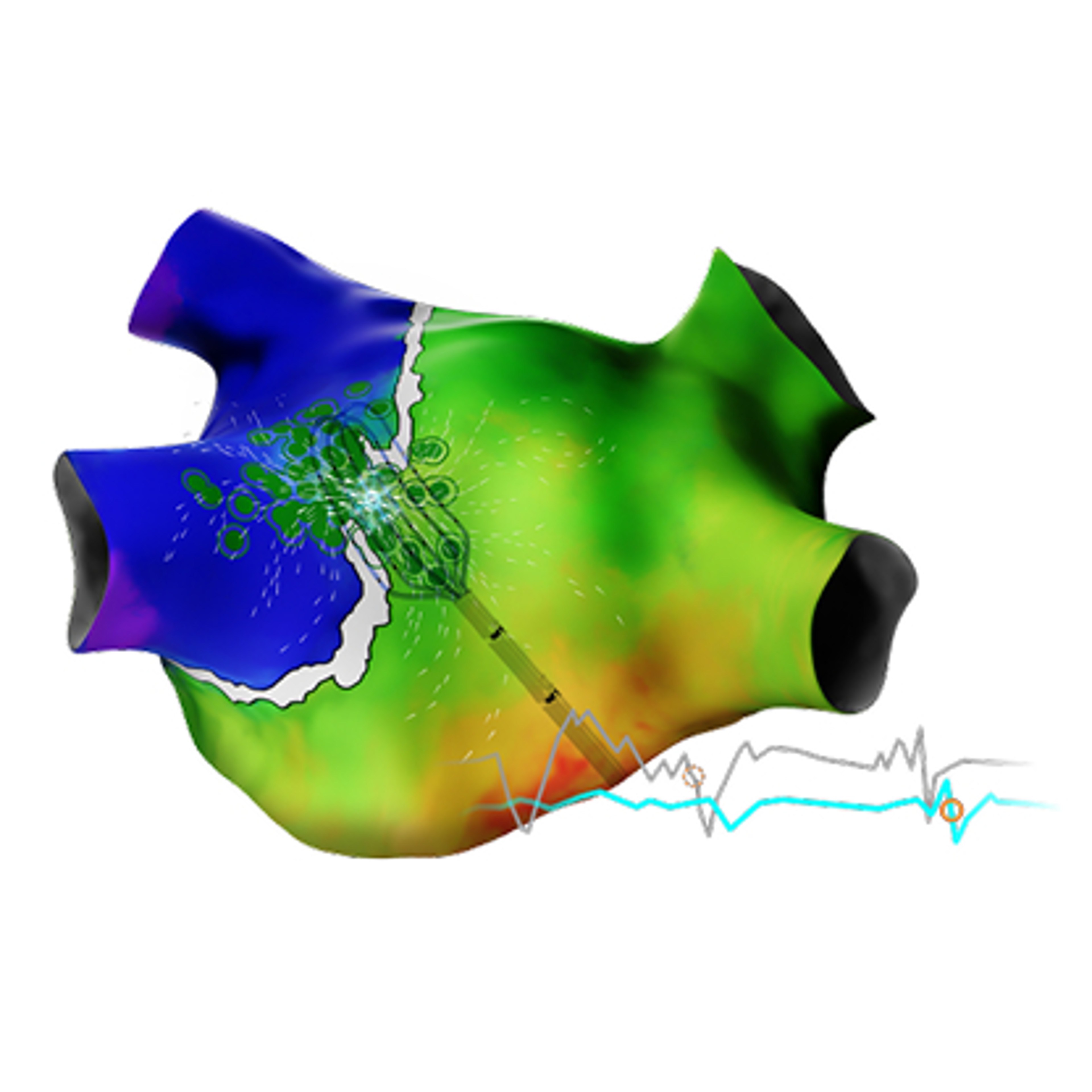 CARTO ELEVATE™ Module