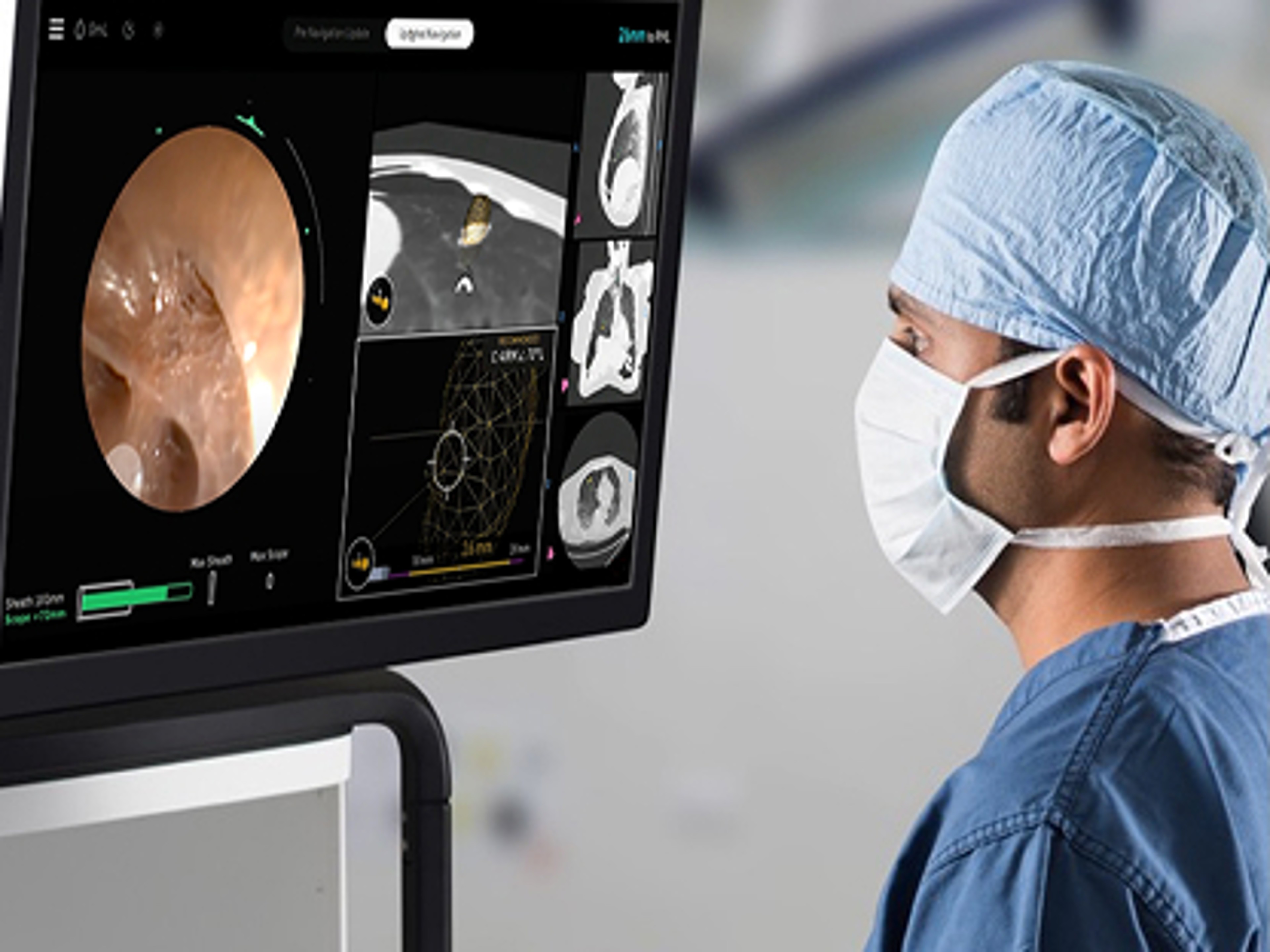 Enhance your ability to go after hard-to-reach lung nodules