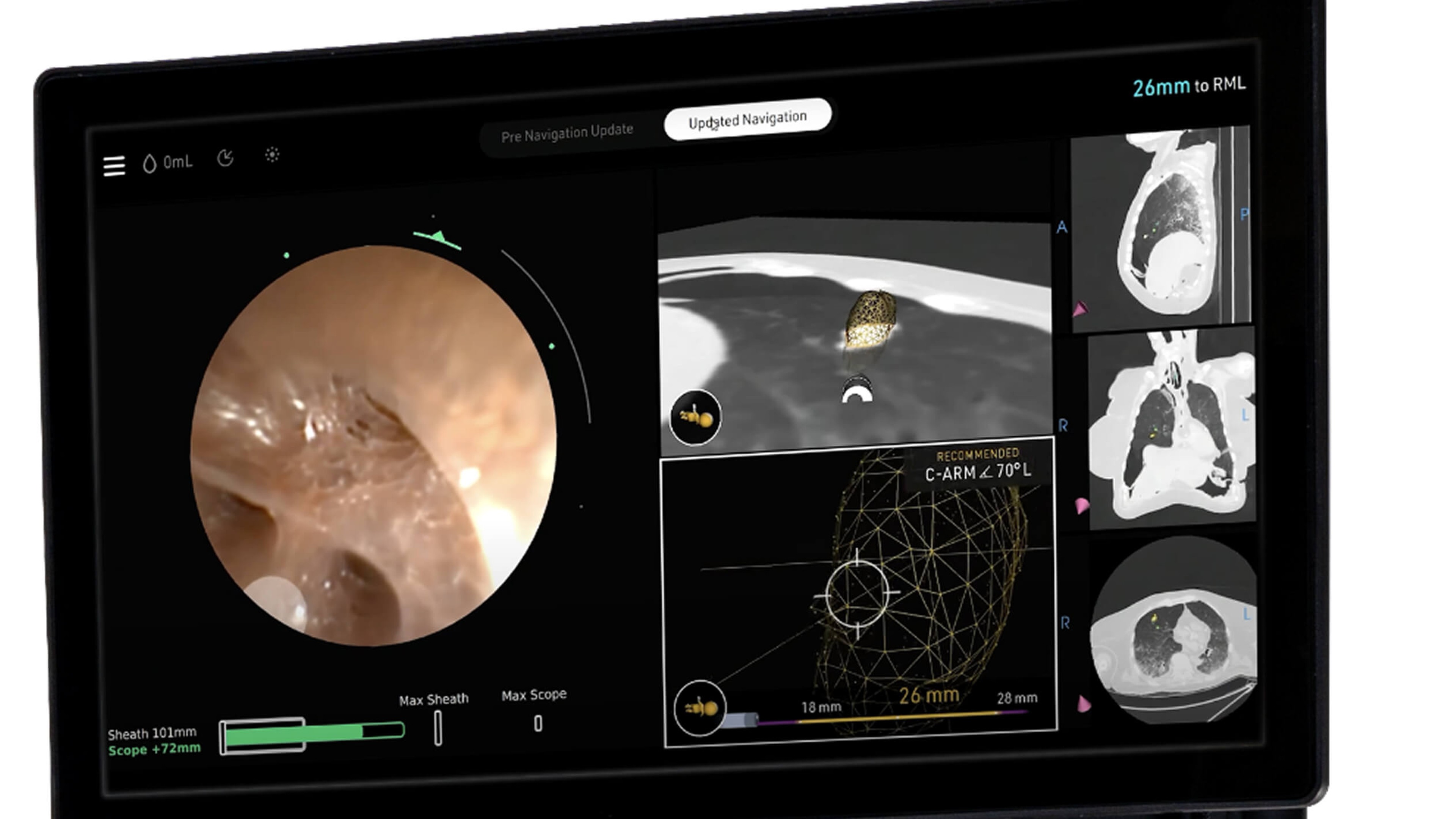 Real-time visualization