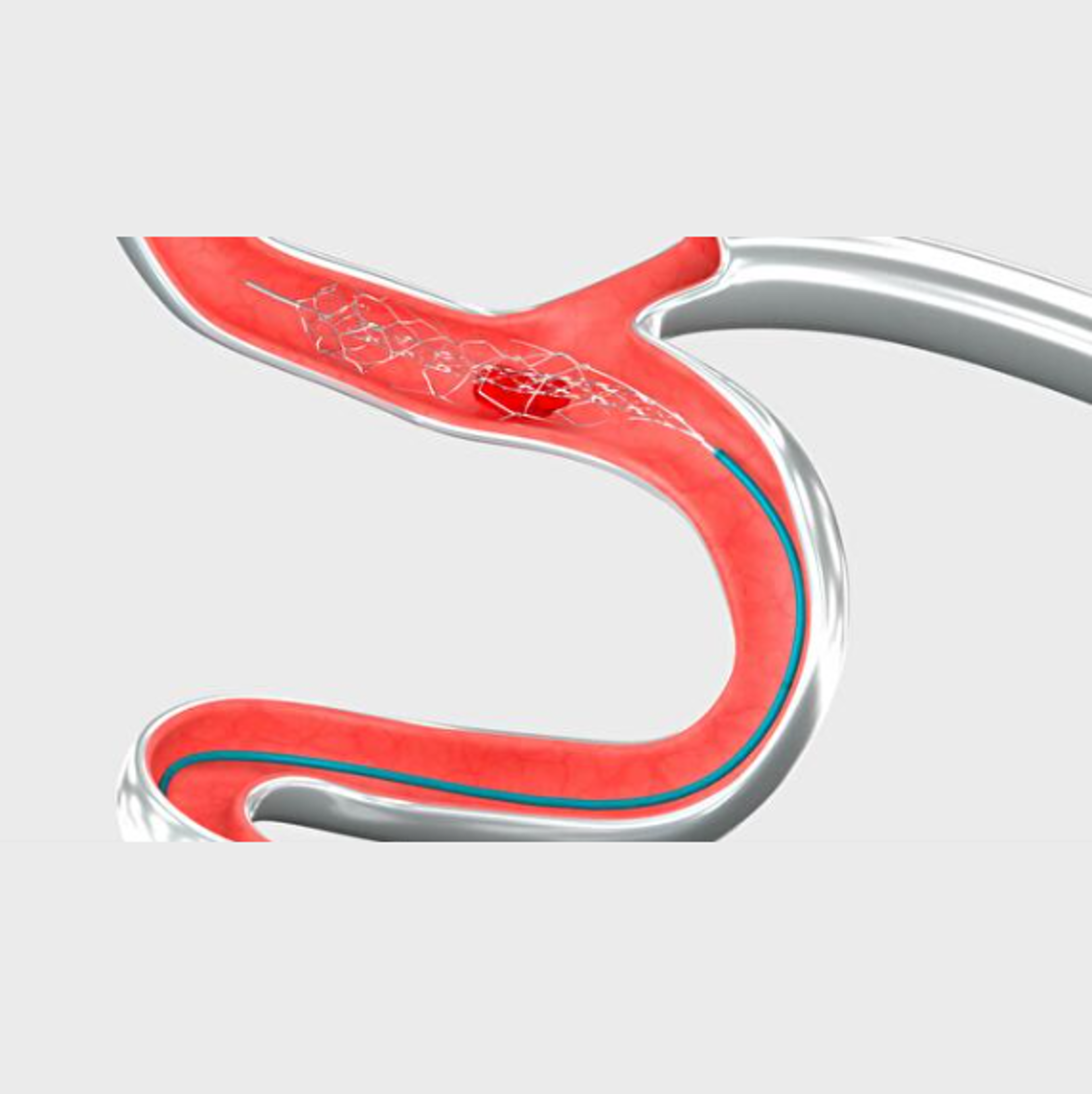 EMBOTRAP® III Revascularization Device