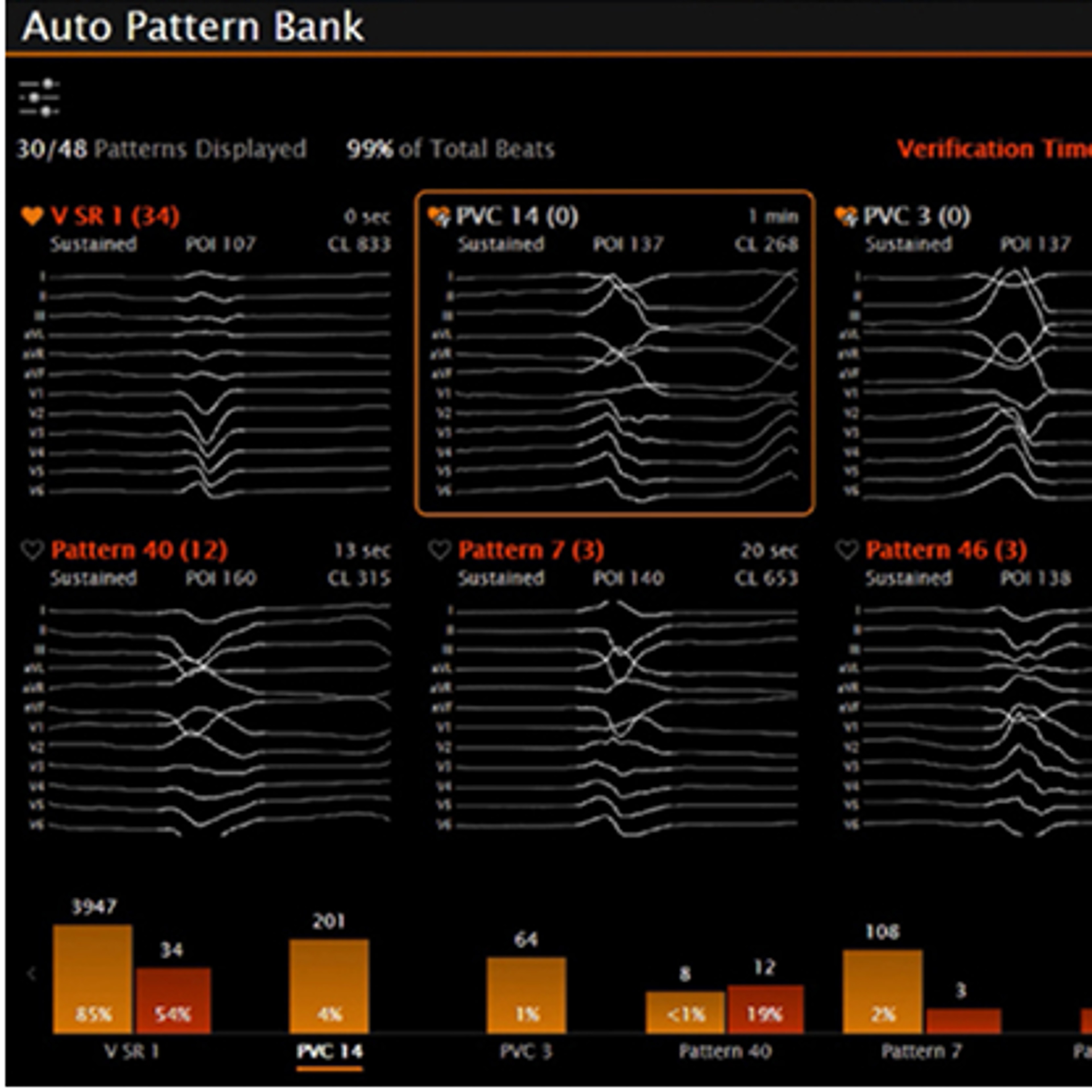 Automatic Pattern Acquisition (APA)