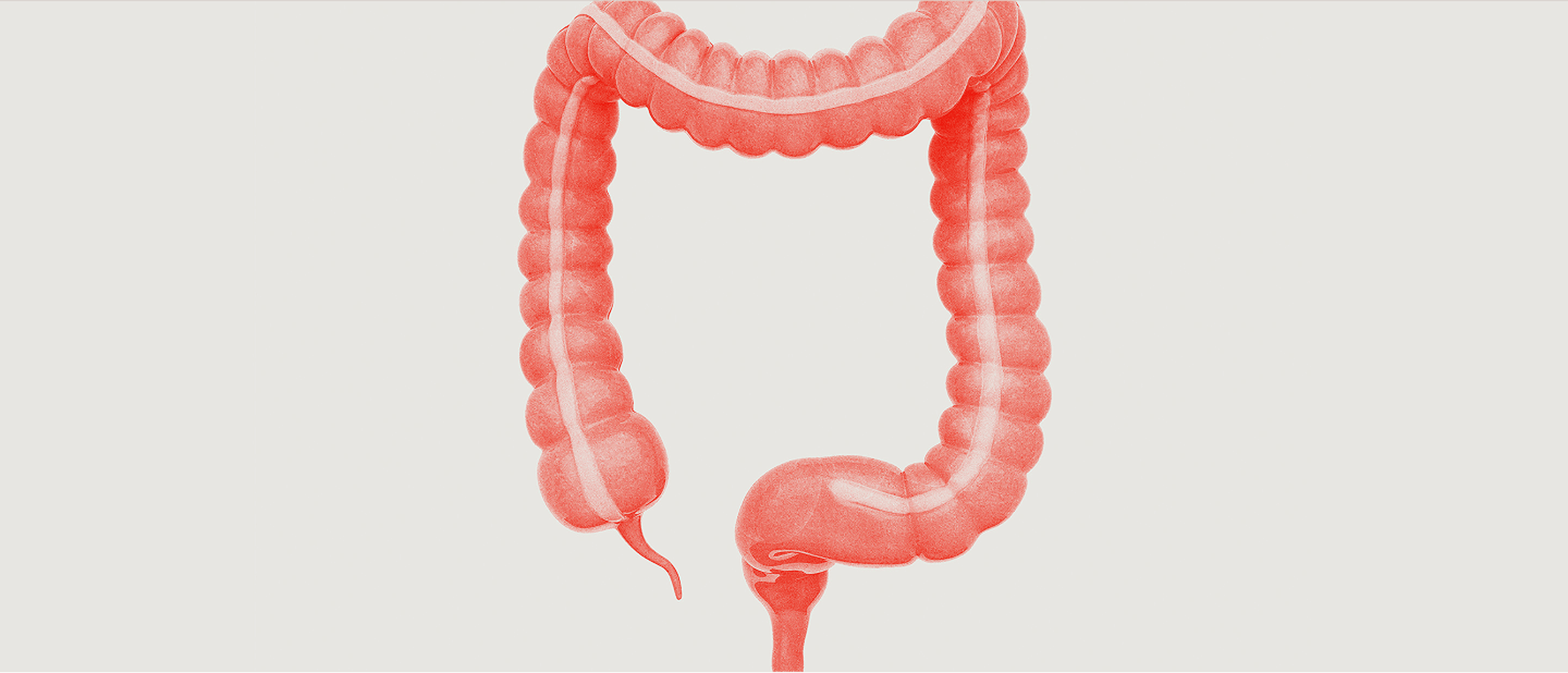 Colon & rectal