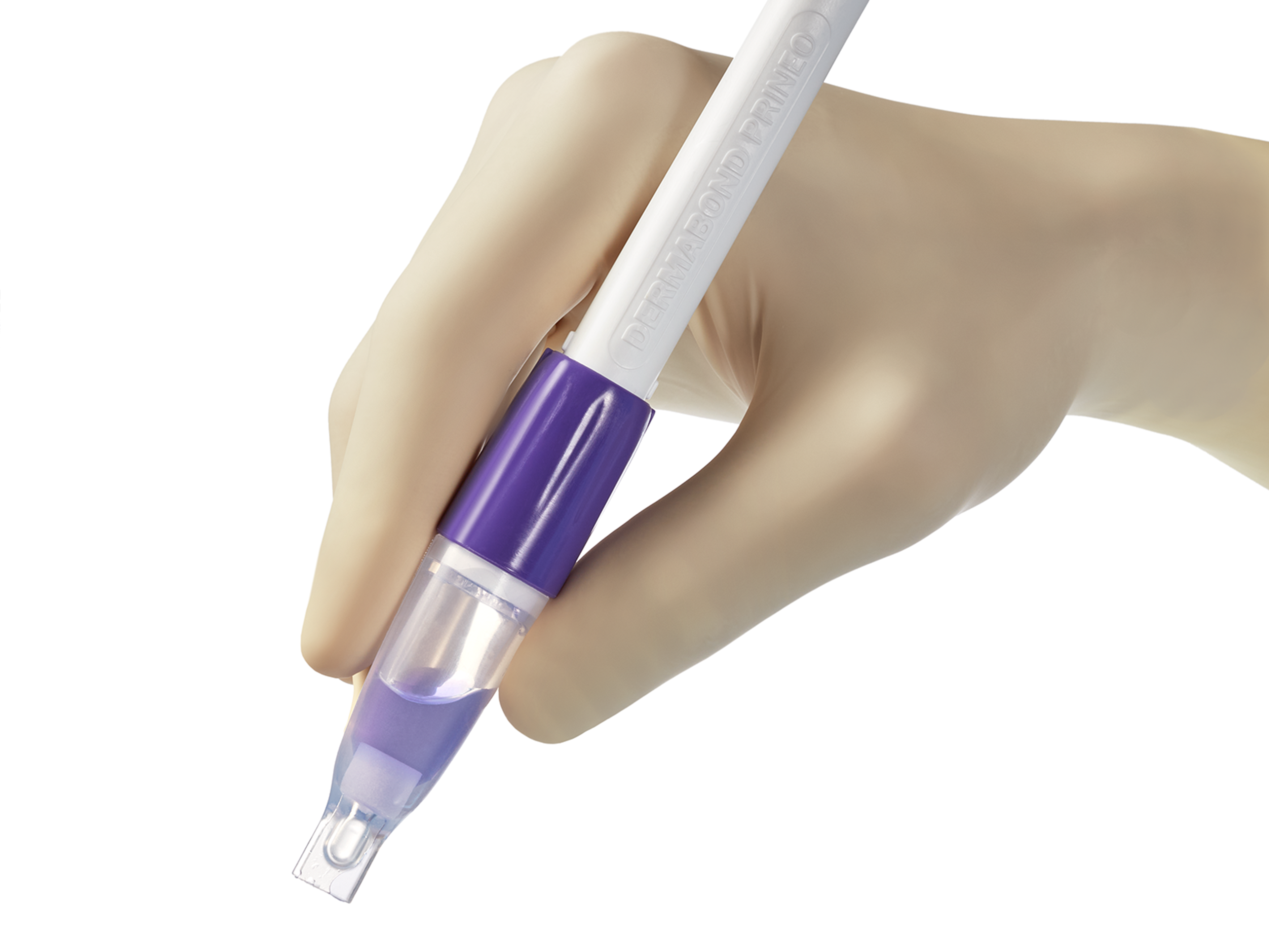 DERMABOND™ PRINEO™ Skin Closure System