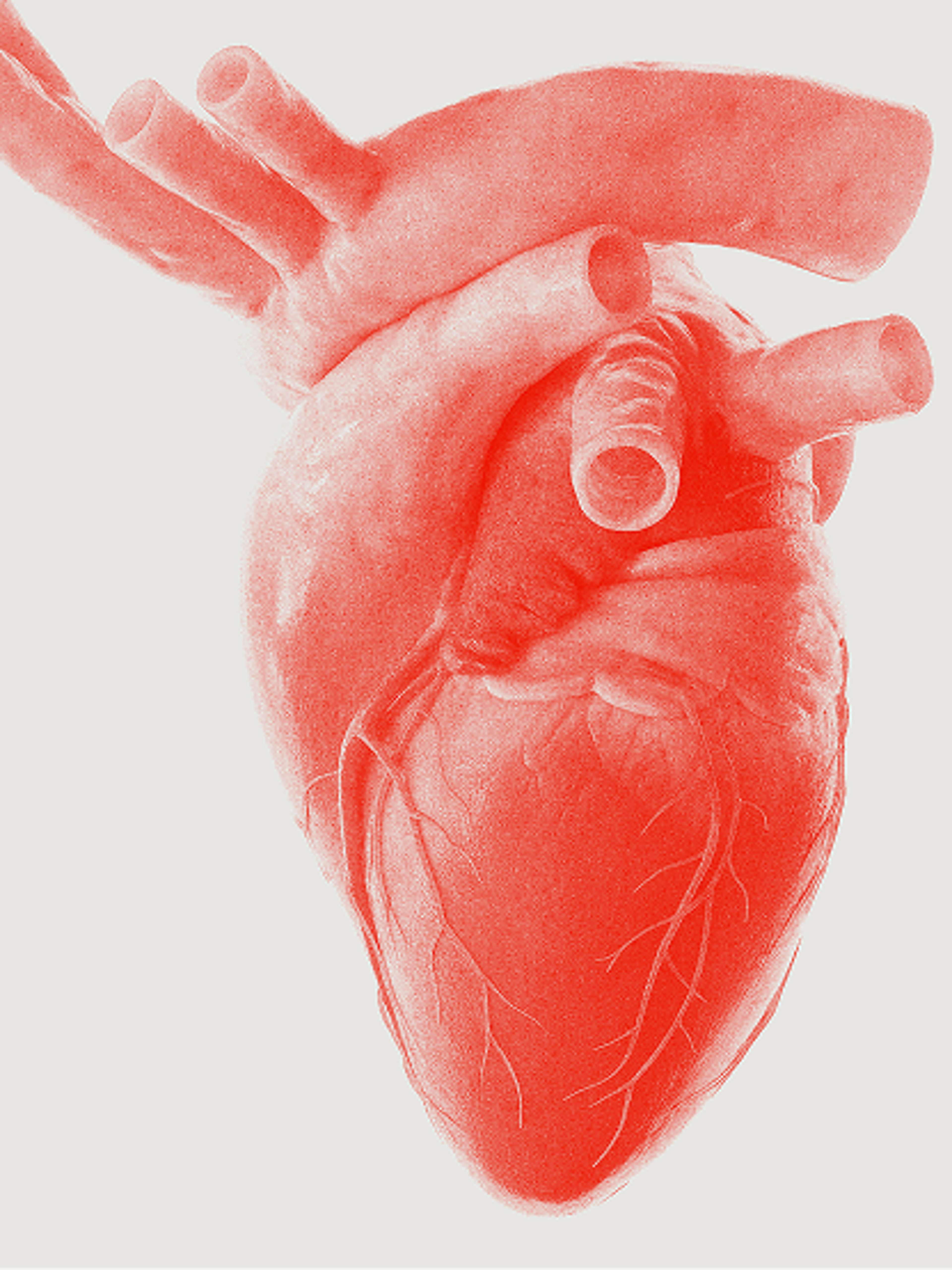 Cardiothoracic