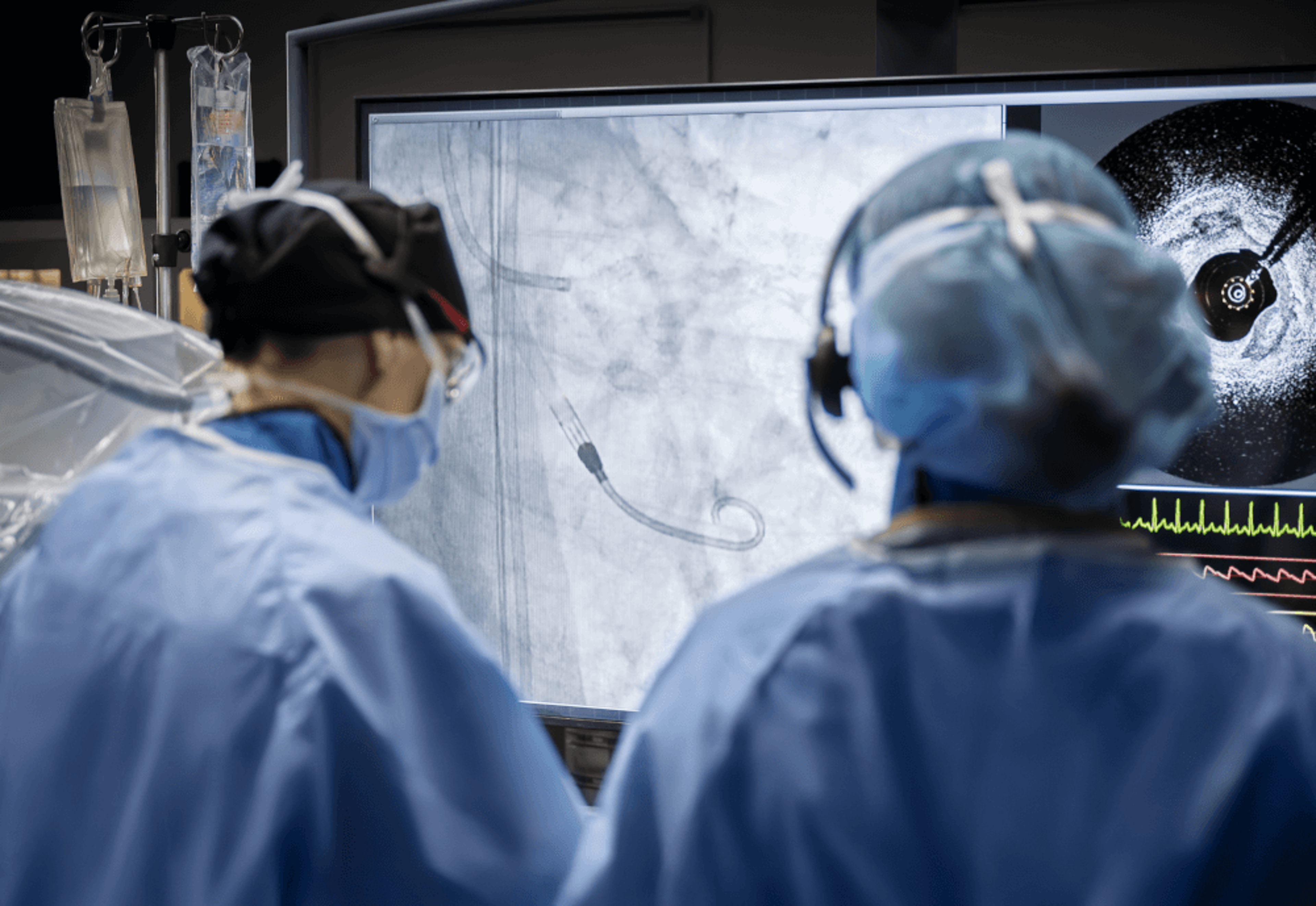 A team is performing an endovascular procedure with an Impella heart pump. There is a fluoroscopic image from impella placement on the screen.