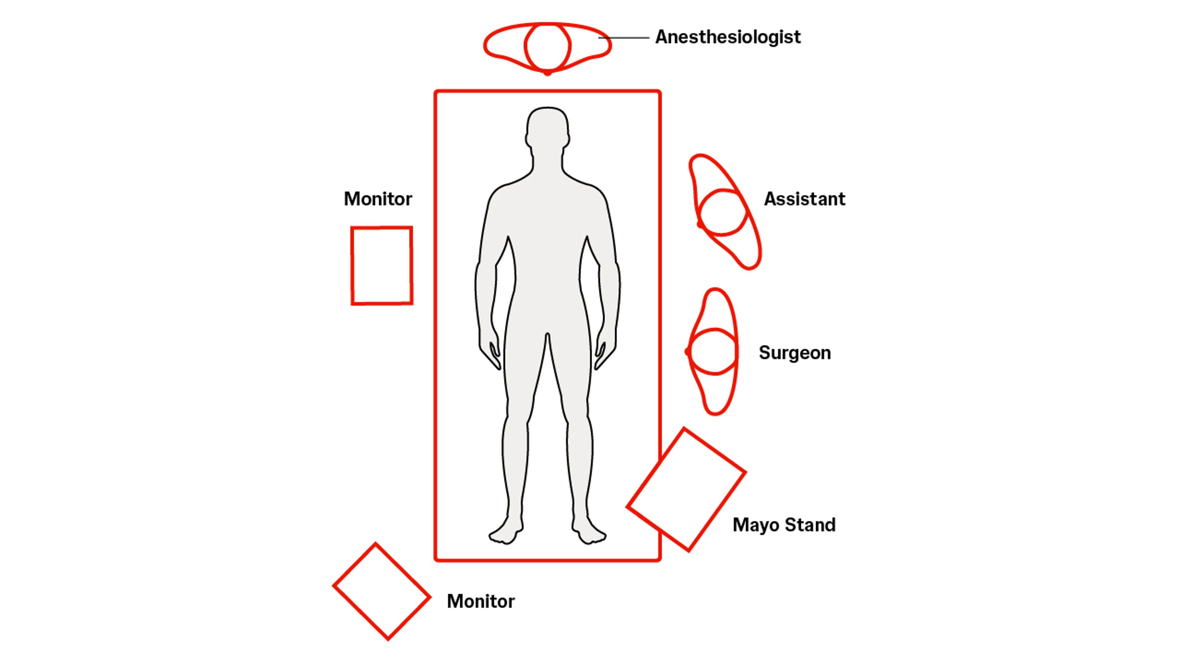 Laparoscopic appendectomy