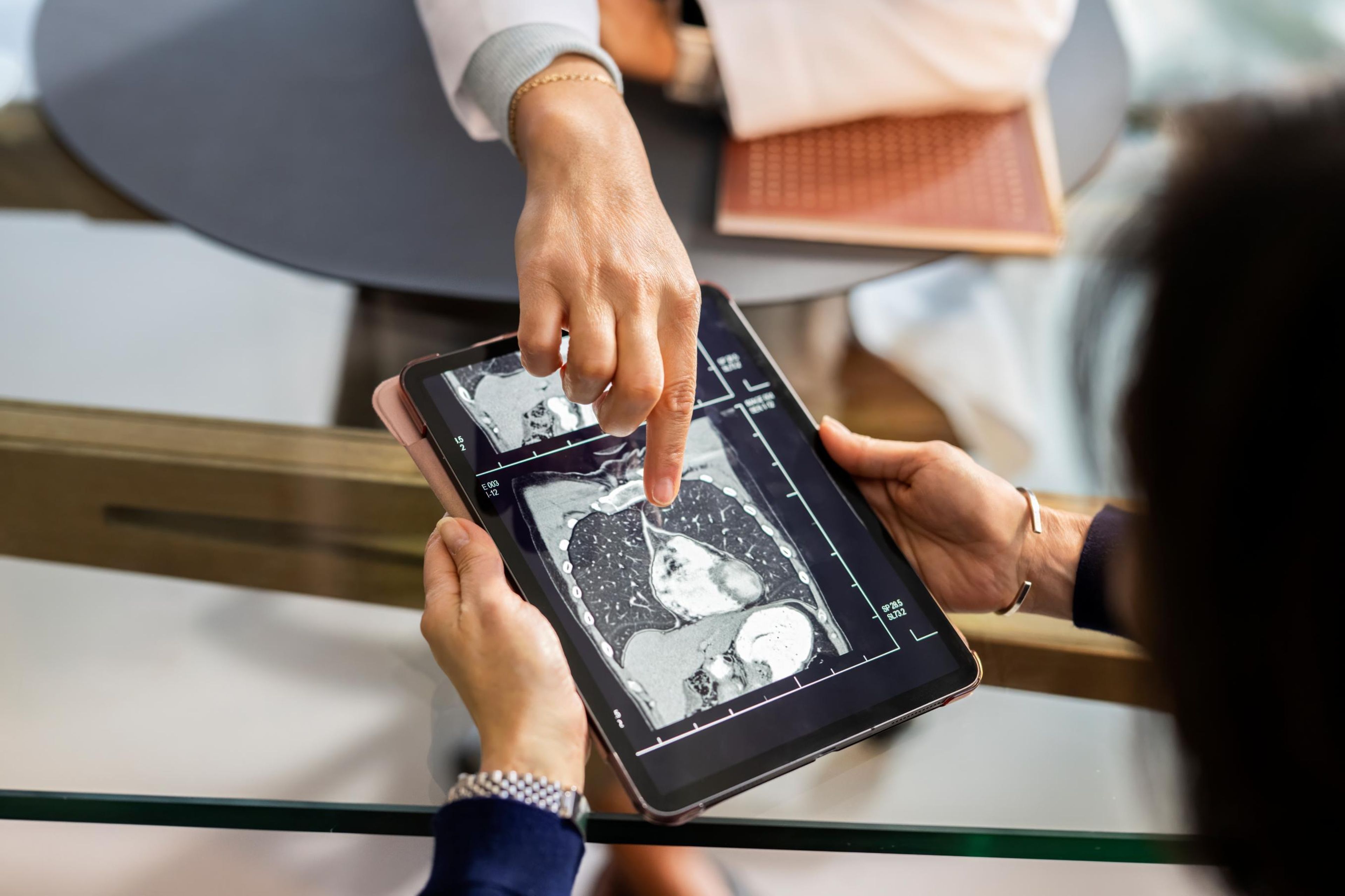 The race to detect, diagnose and treat lung cancer