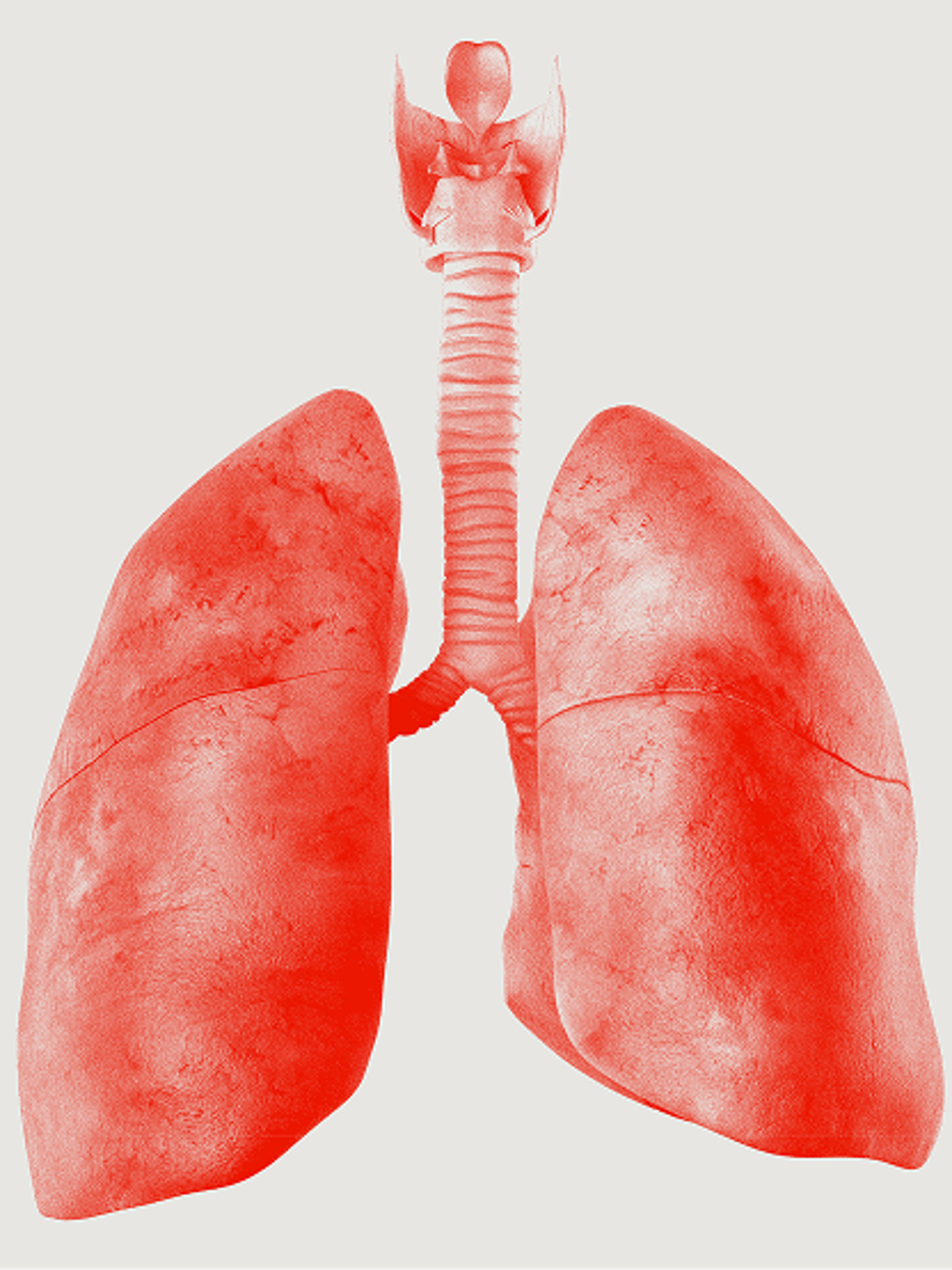 Interventional pulmonology