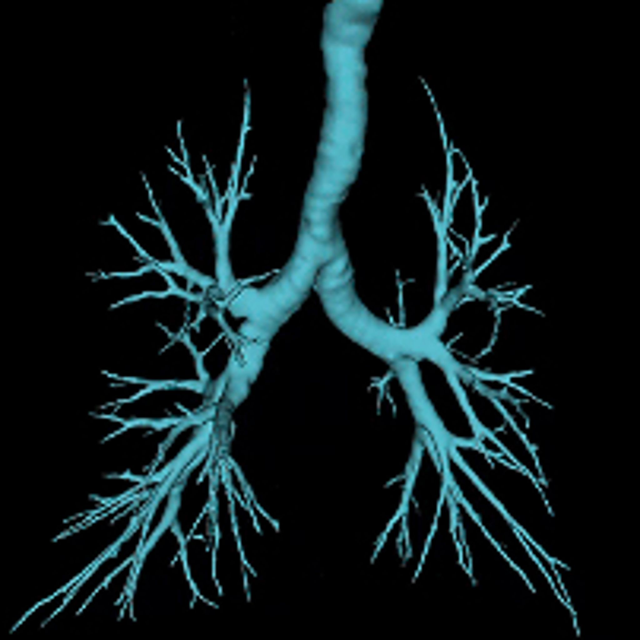 MONARCH Platform | Robotic-assisted bronchoscopy (RAB) | J&J MedTech US