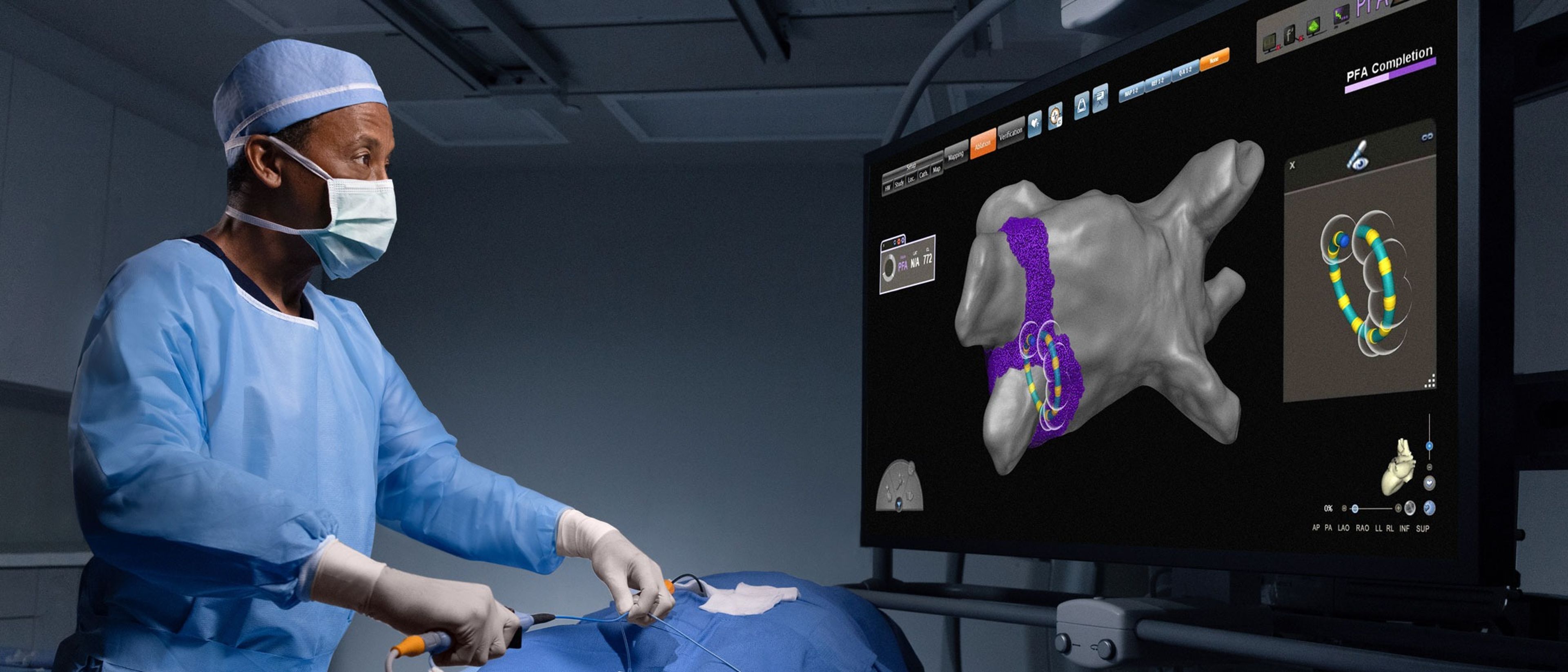 A clinician in surgical attire positions the VARIPULSE™ Catheter while monitoring a large display that shows a 3D model of the pulmonary vein region.