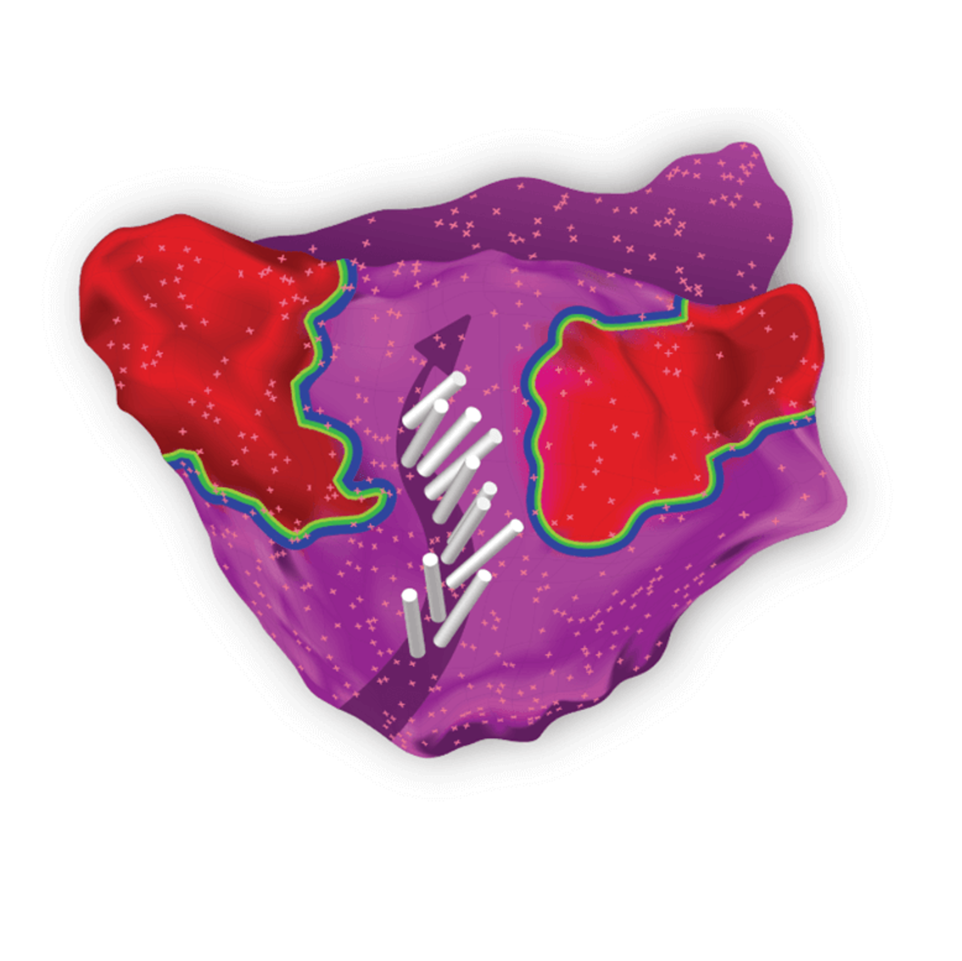 Ripple mapping a human heart
