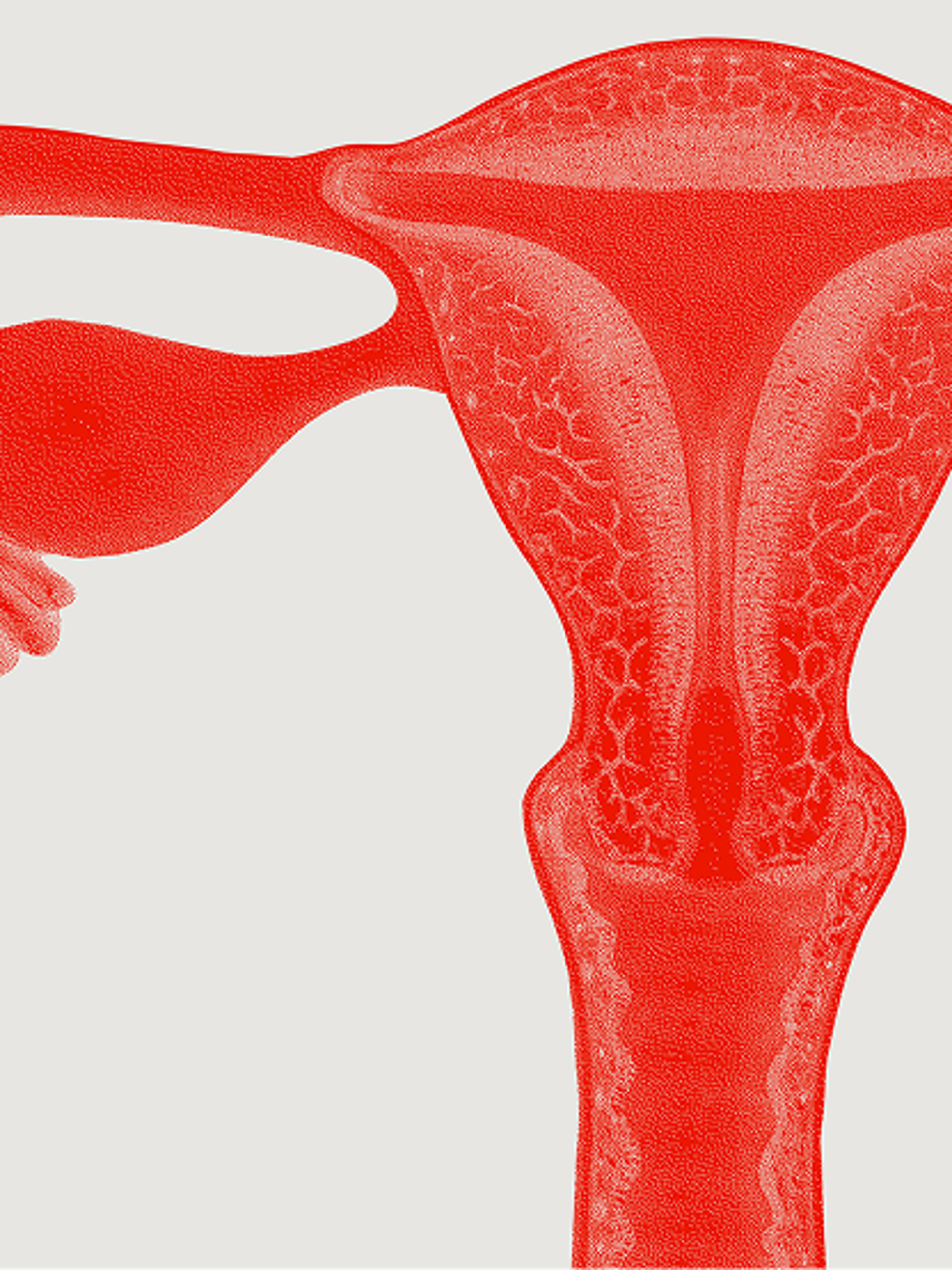 An image of a woman's uterus