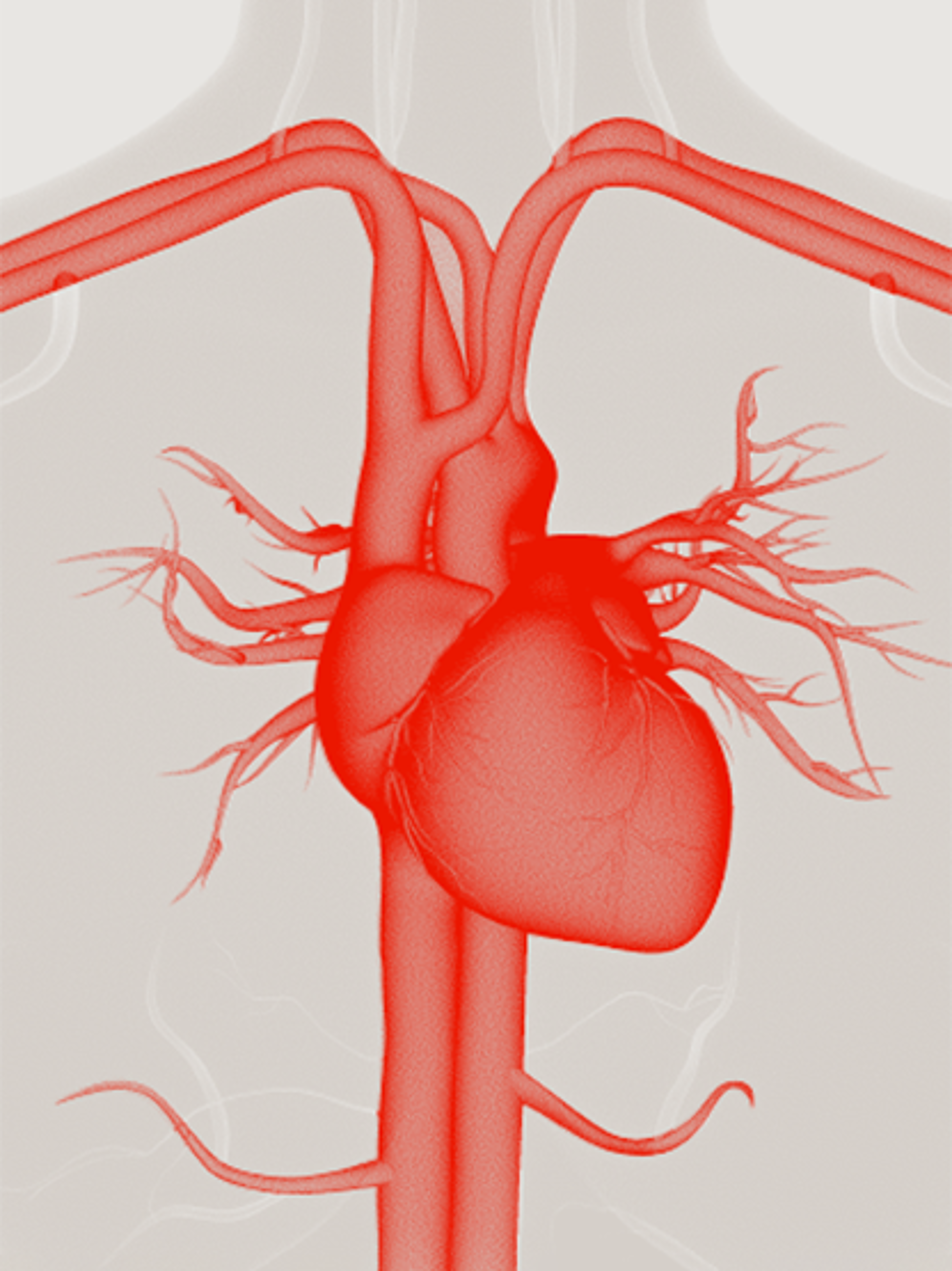 Red anatomical illustration of the human heart and major blood vessels, showing arterial branches extending from the aorta.