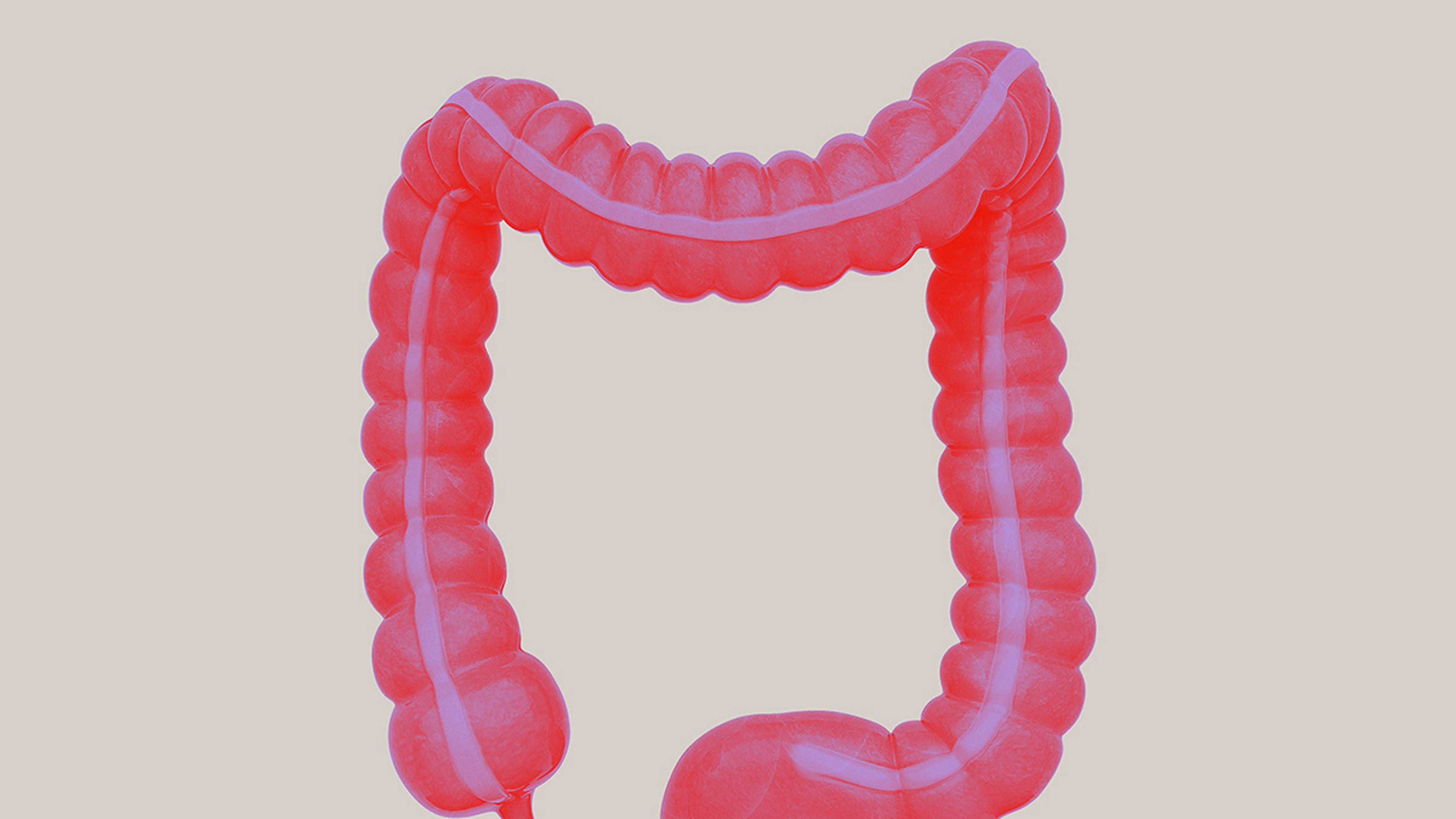 Colorectal surgery complications