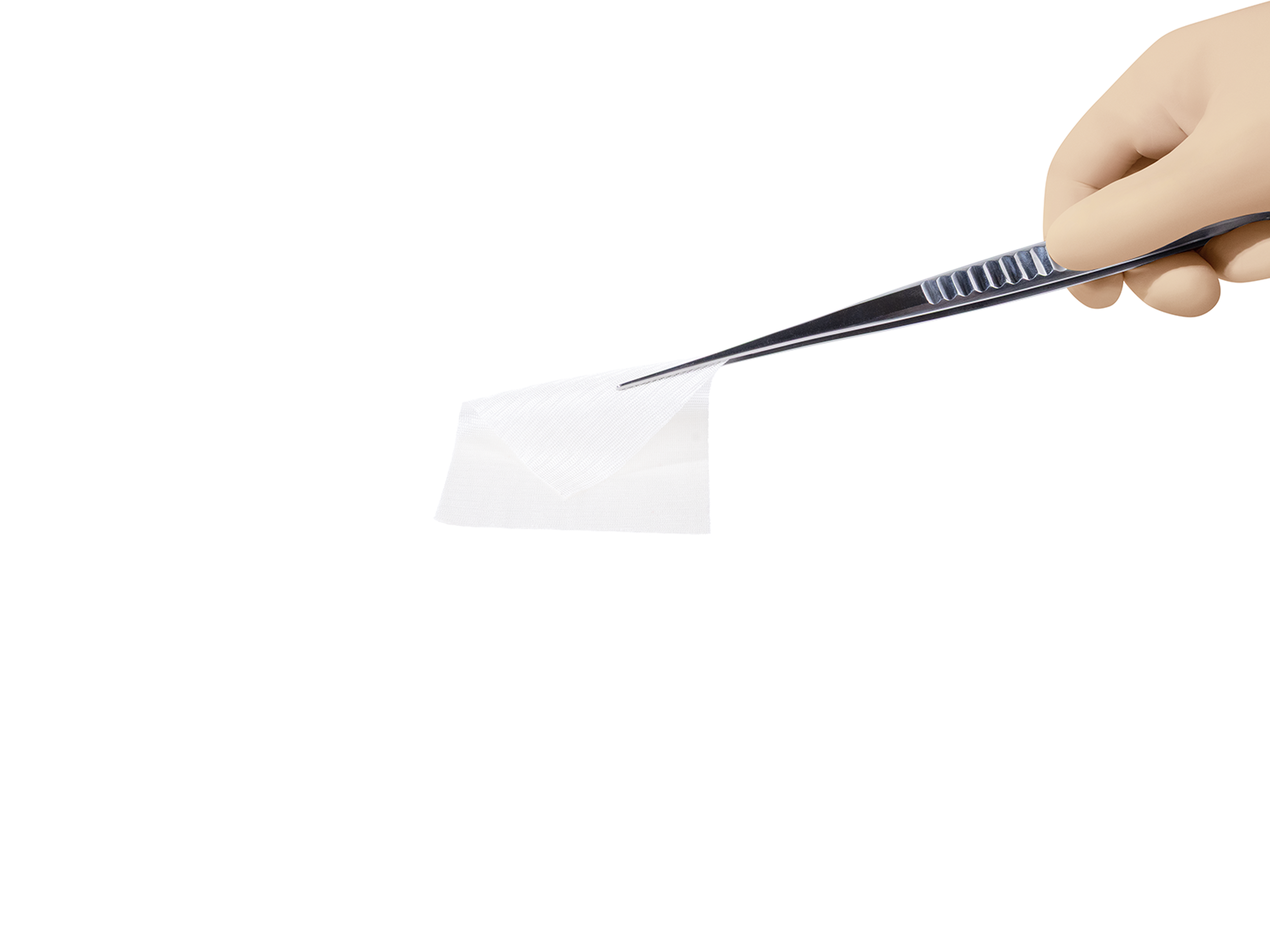 GYNECARE INTERCEED Absorbable Adhesion Barrier