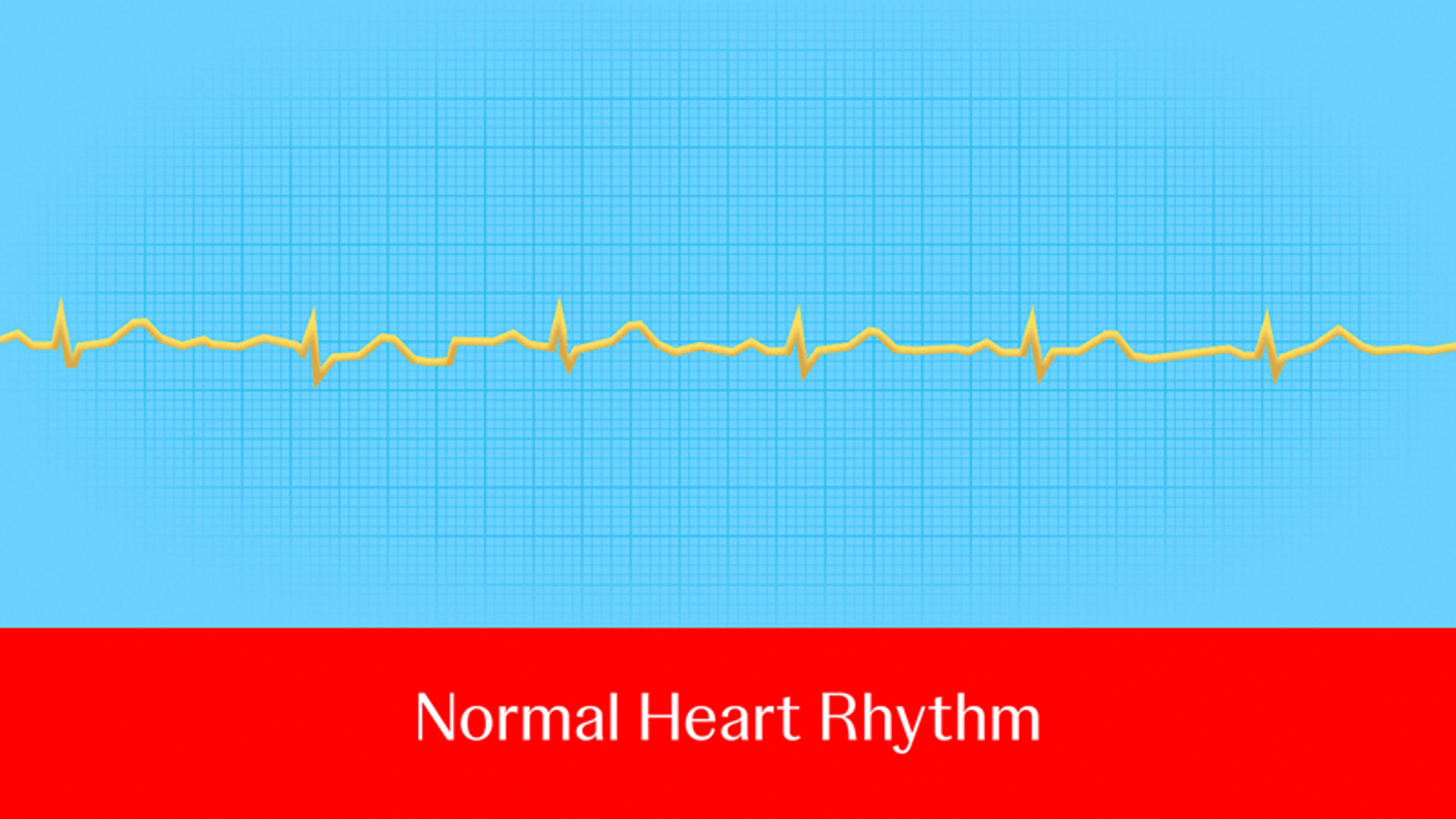 Ask an electrophysiologist: What roles do PFA and RFA play in the treatment of AFib?